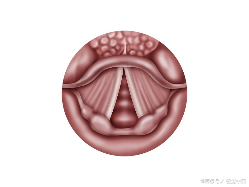 会厌炎一般几天自愈?