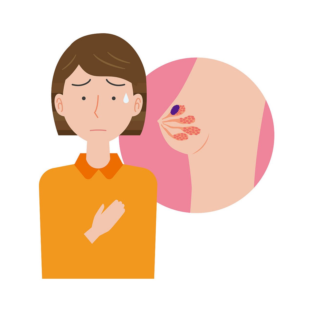 乳腺癌是一种复杂的疾病,其发生和发展涉及多种因素的综合作用,包括