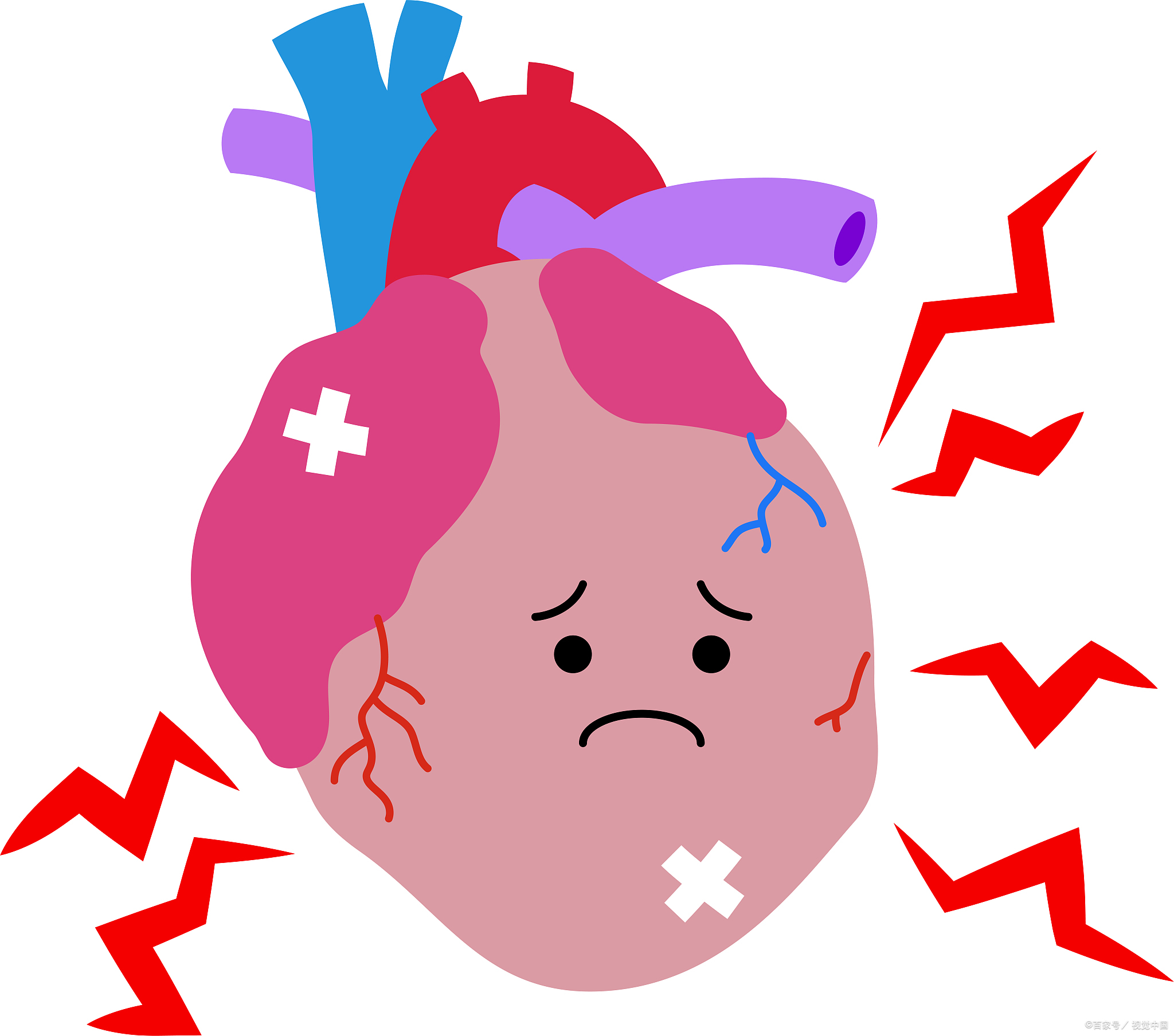 救心丸该怎么正确使用?