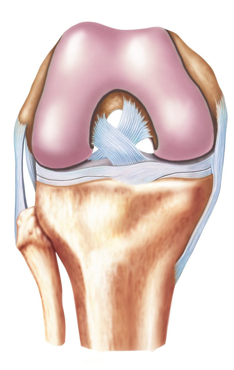 半月板损伤微创手术:科学护理,快速康复 93半月板损伤是运动损伤中