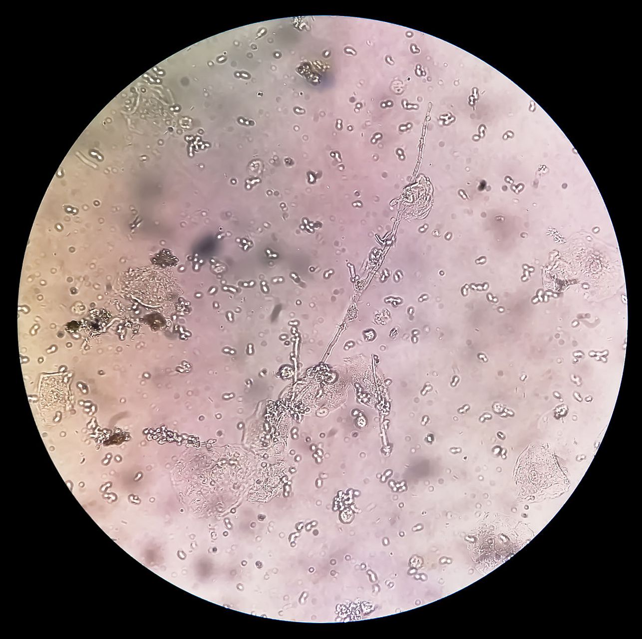 首先,咱们得明白尿路感染是怎么来的