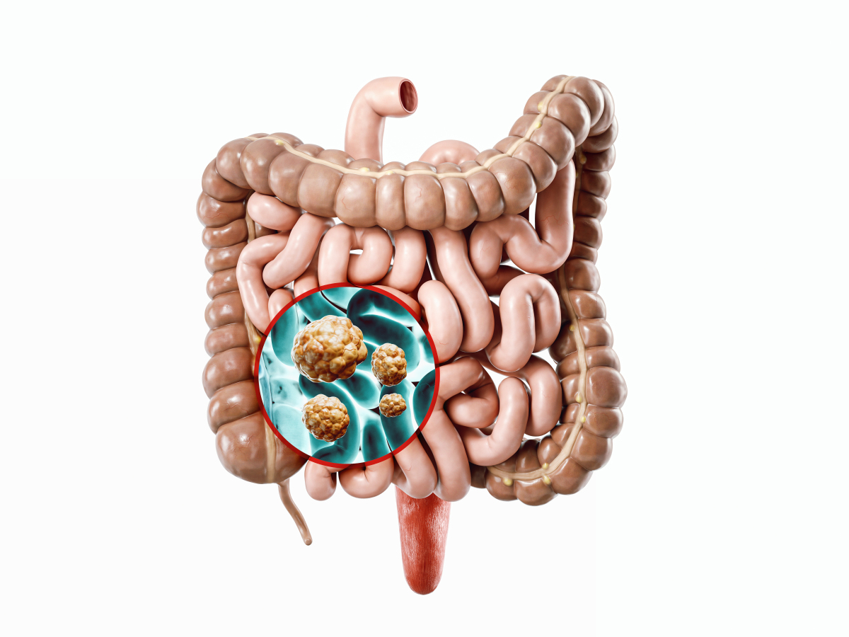 Trilostane treatment | Shaanxi BLOOM Tech Co., Ltd Trilostane treatment | Shaanxi BLOOM Tech Co., Ltd
