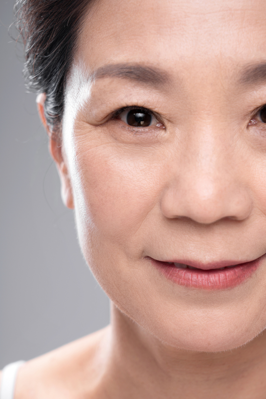 除皱针后,鱼尾纹护理要点  鱼尾纹打了除皱针后,要