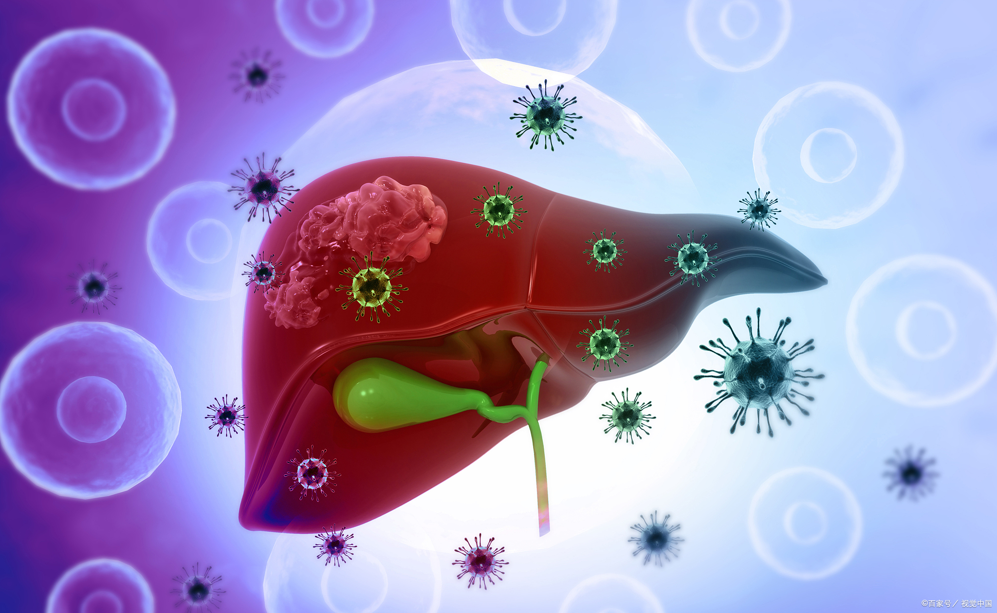 hbv-dna即乙型肝炎病毒脱
