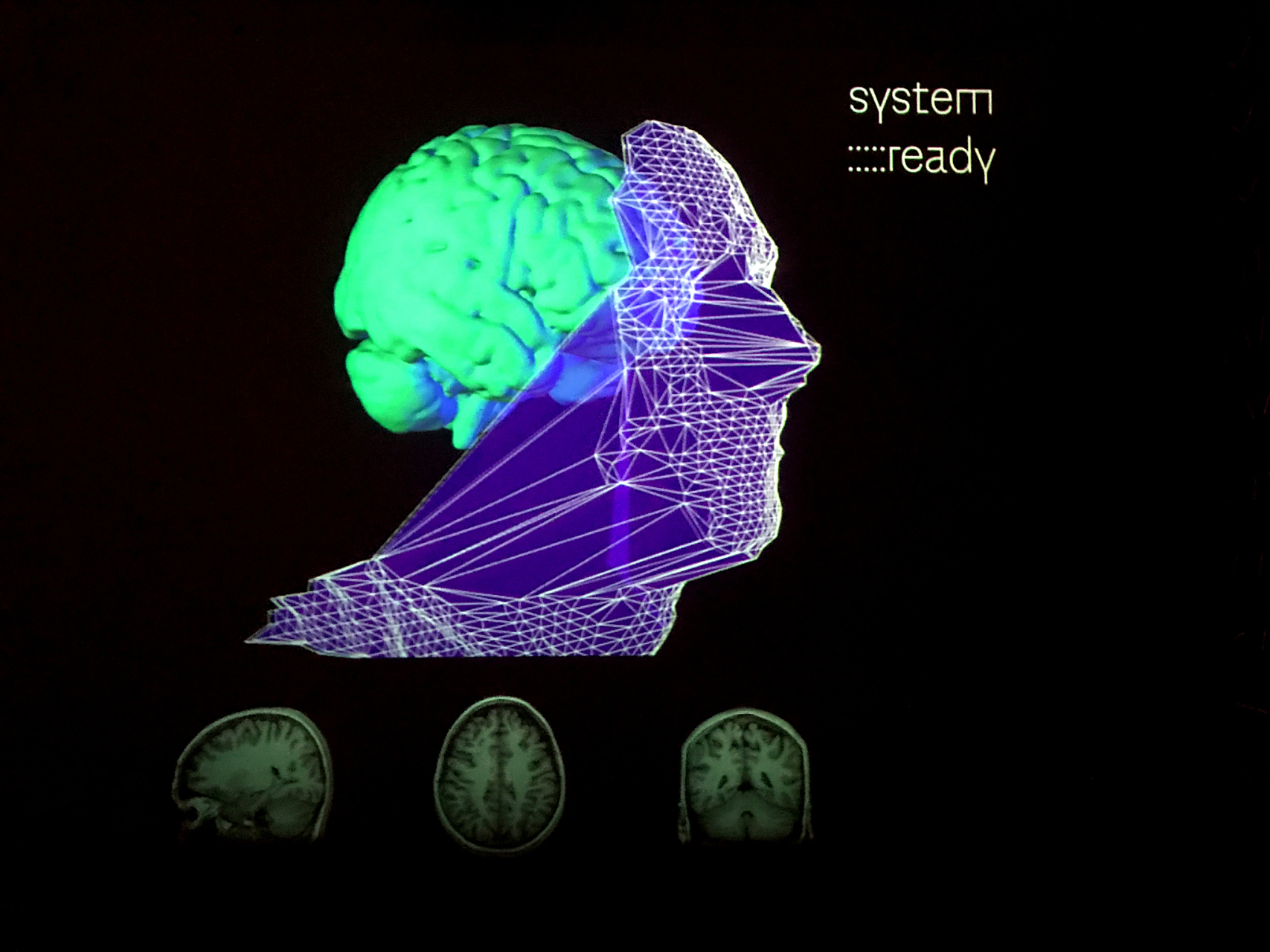 中国科学家首次实现小鼠"深脑成像"
