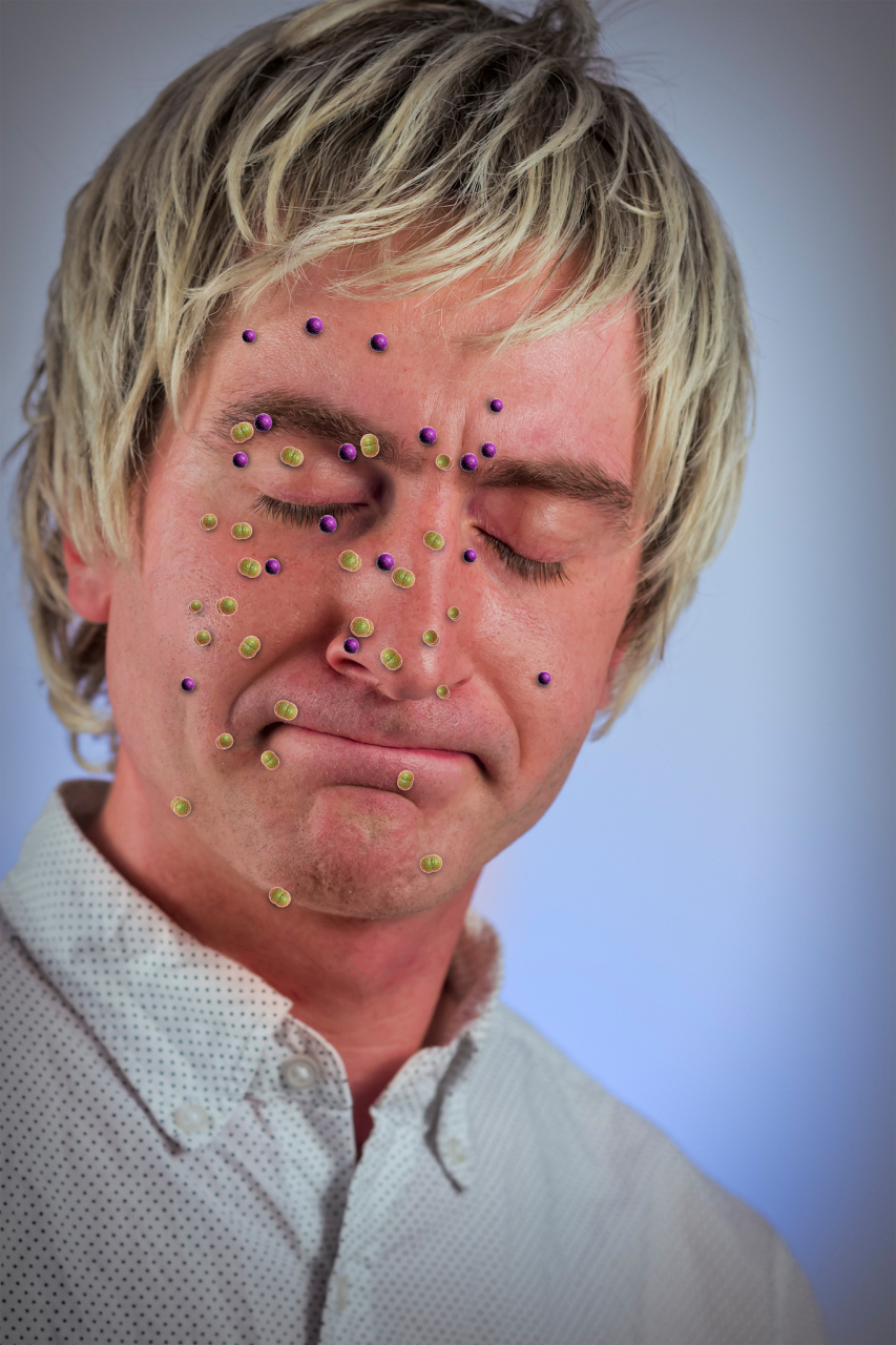 肝病面容:医生眼中的"健康警示灯" 在医学领域,肝病面容被视为一种