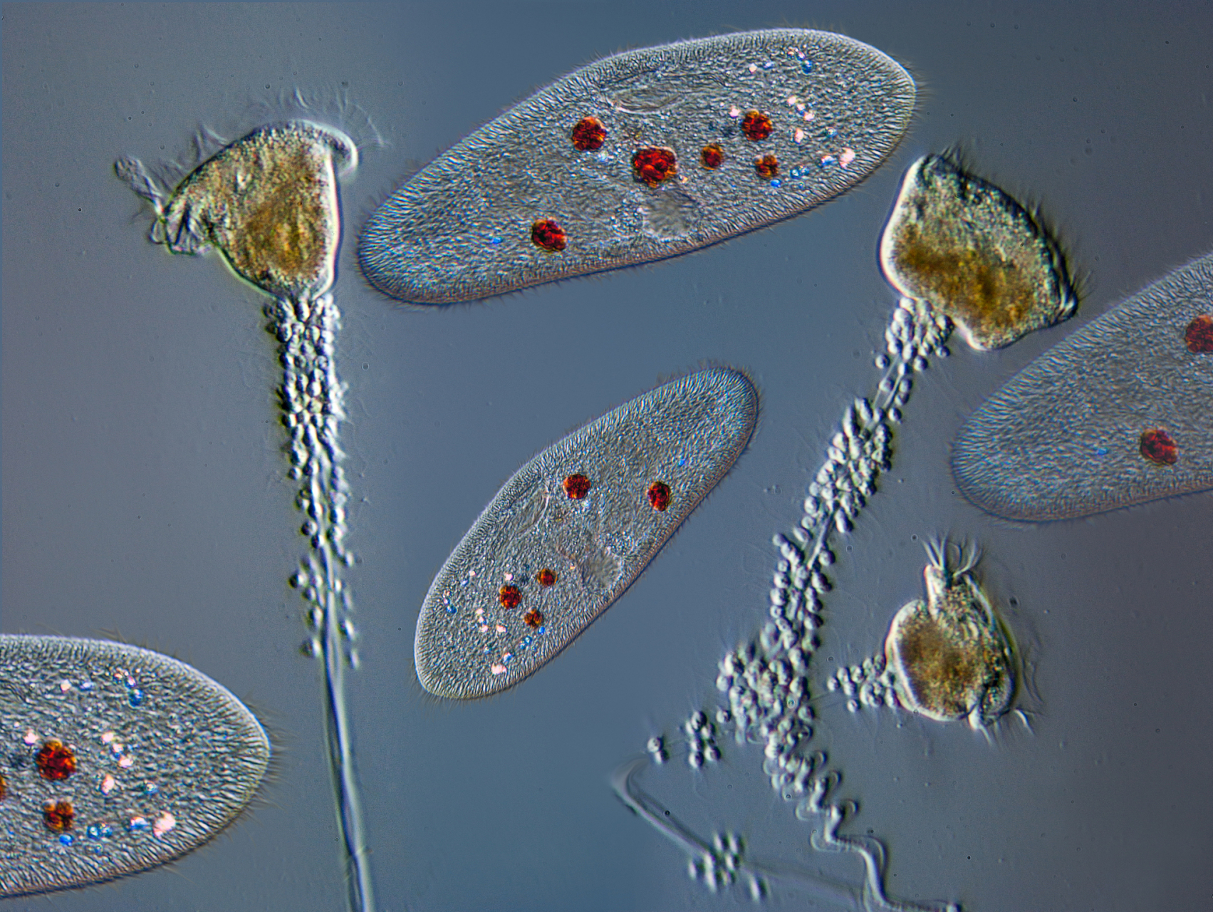 "食脑变形虫"实际是阿米巴原虫的一种,学名叫做福氏耐格里变形虫,它是