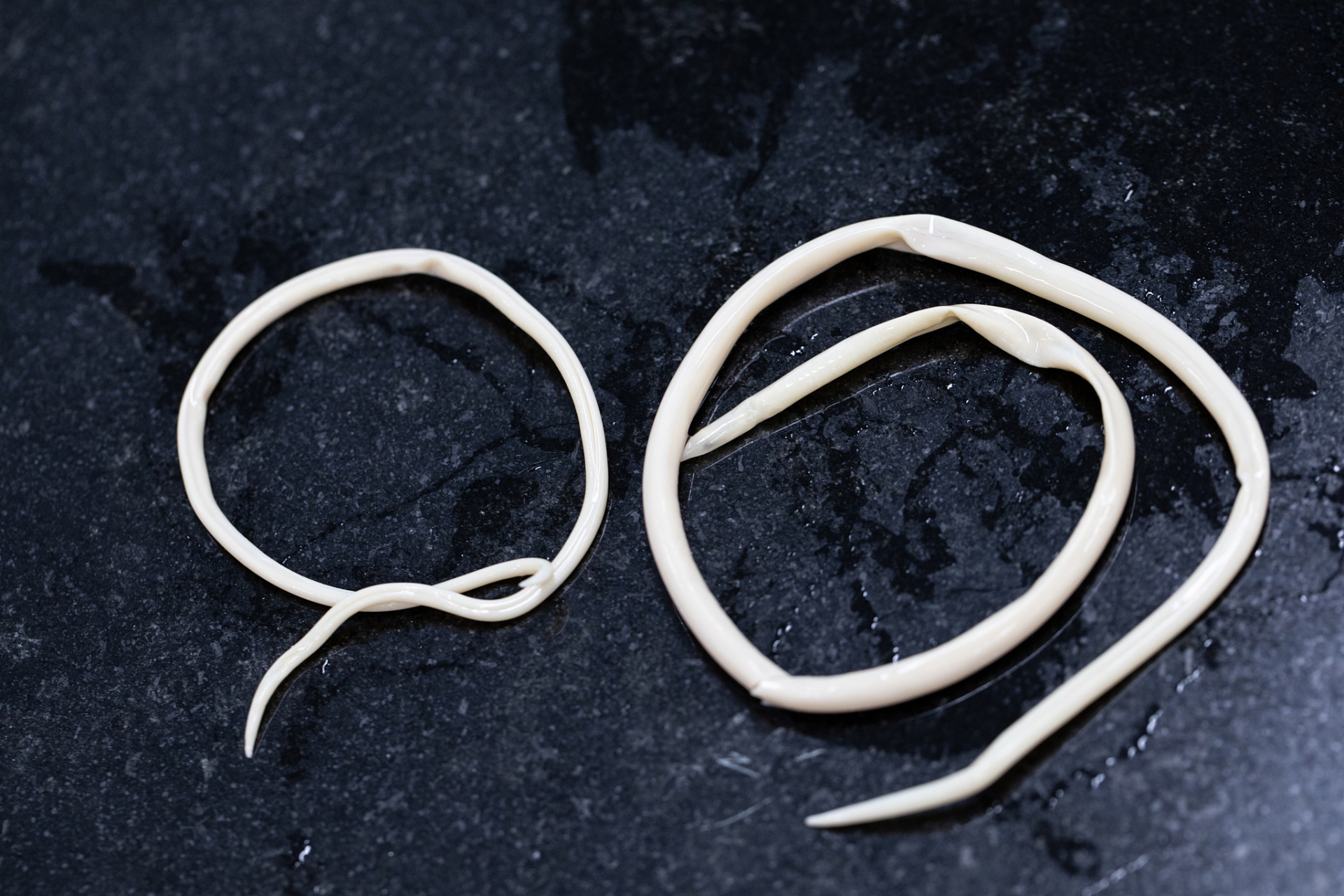 什么人容易感染蛔虫?