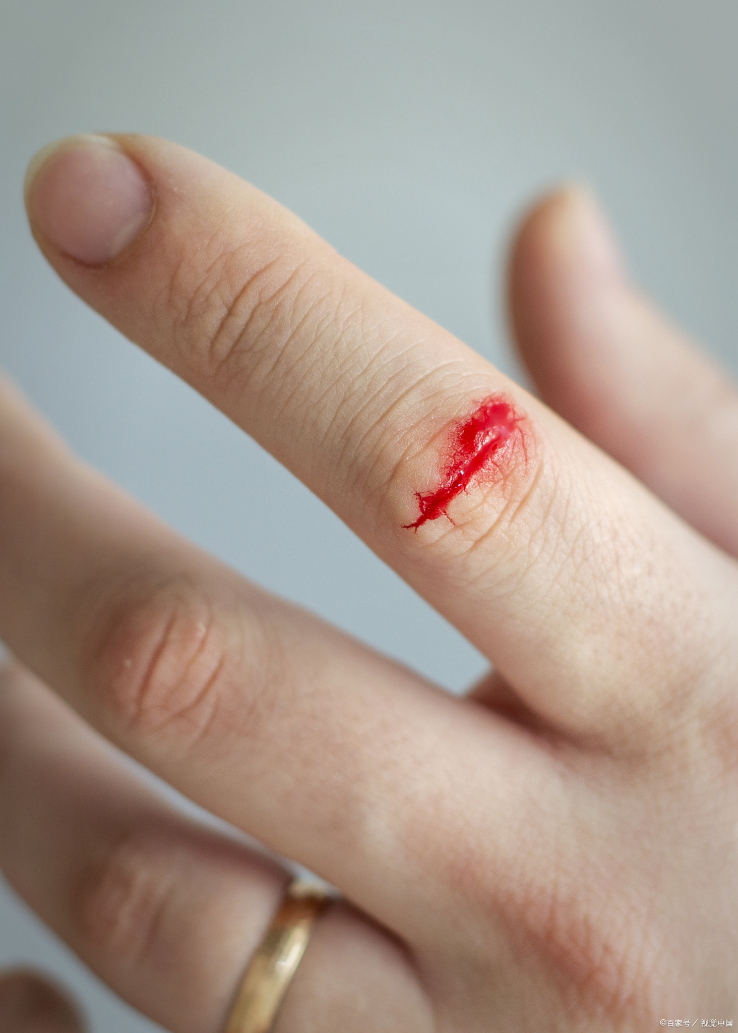 不小心被划破手指,第一反应就是冲到水龙头下冲洗!
