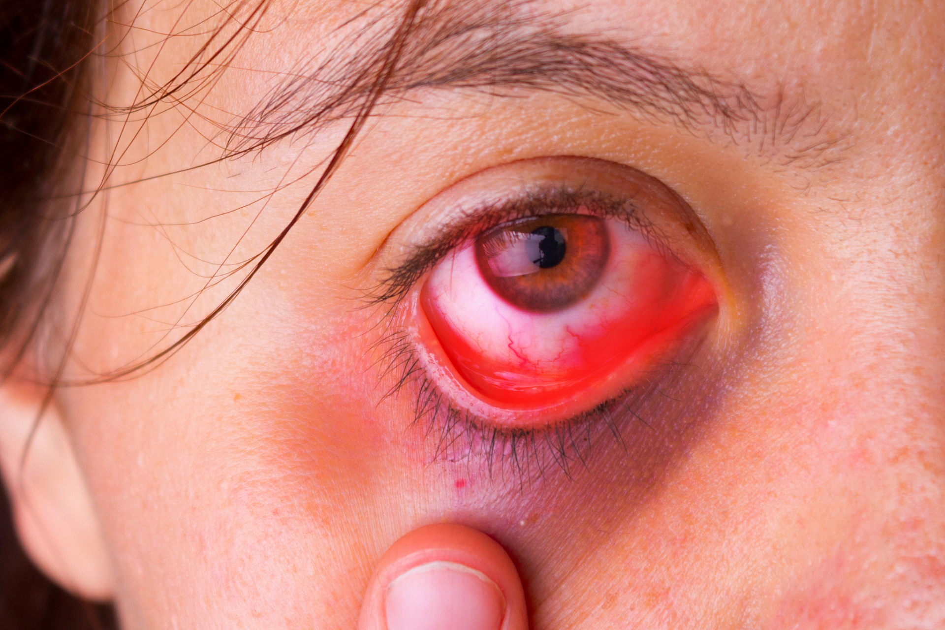 兔子的眼睛为什么是红色的