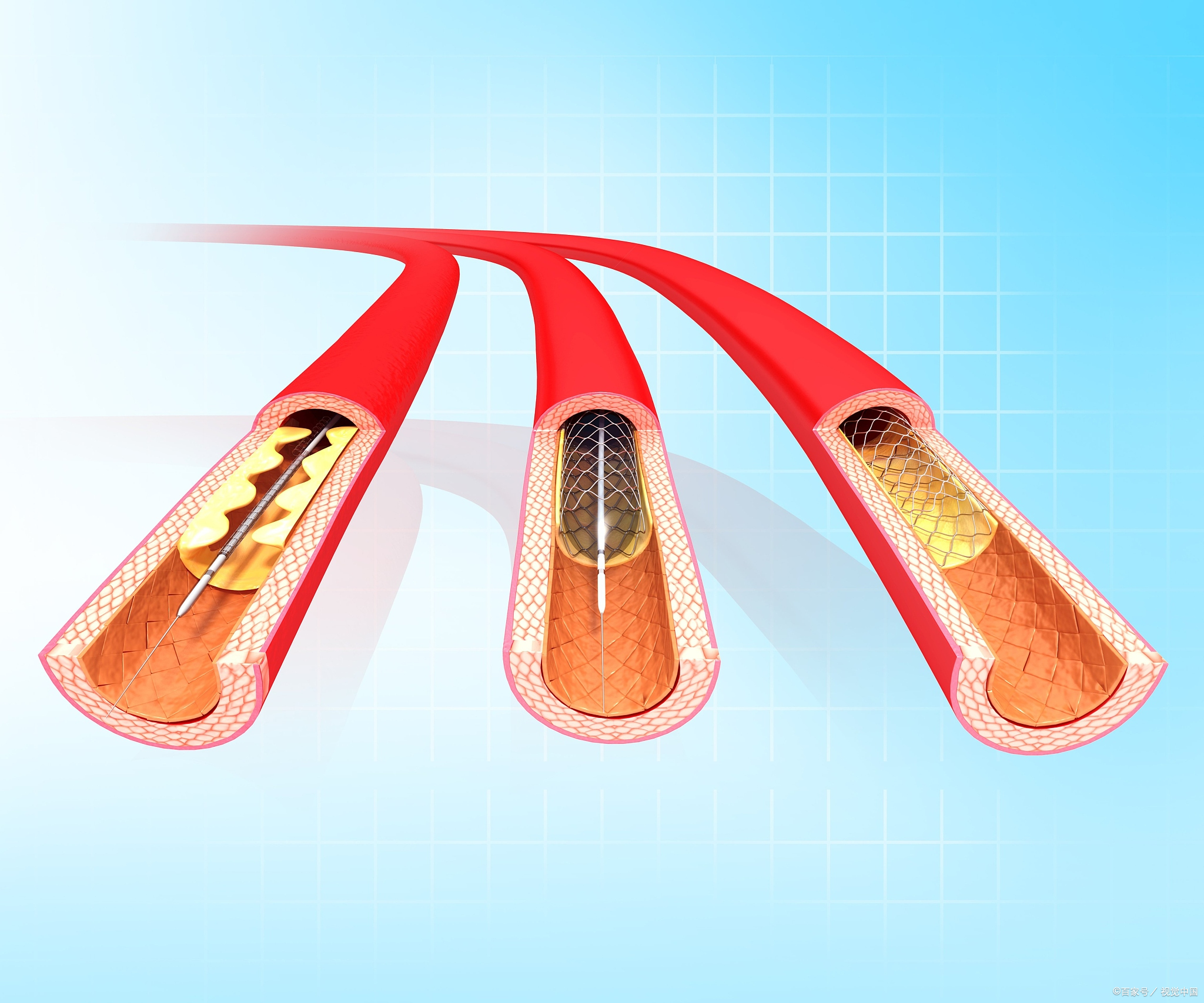 大蒜,是血管的清理工.@上海龙华医院汤主任的动态