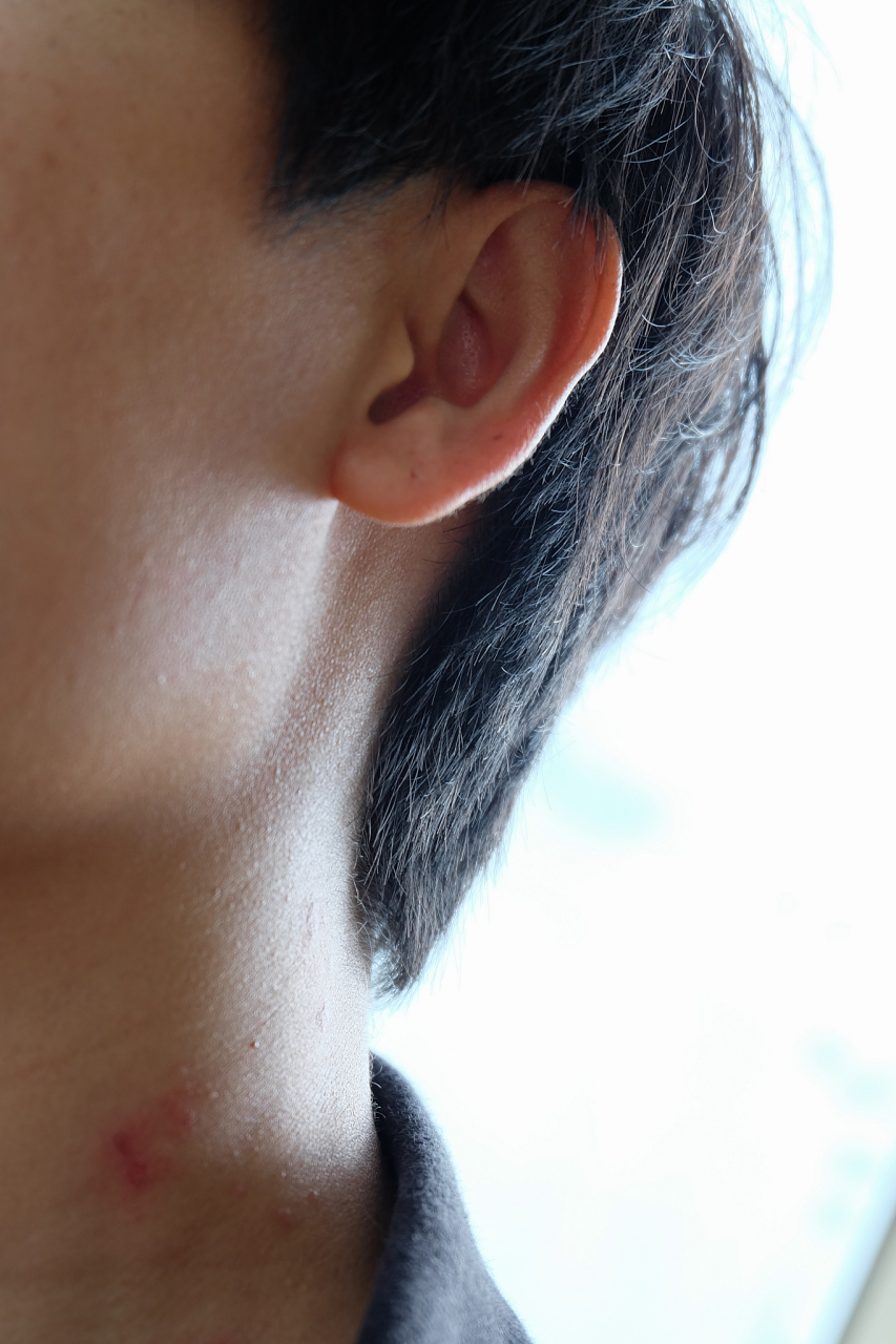 出去一周回来发现男朋友肩膀上好多草莓印,他说是陪领导去唱歌,乙方