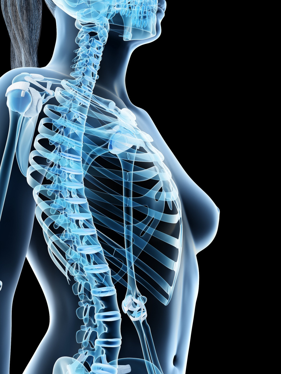 胸椎12压缩性骨折潜在的后遗症 98胸椎12压缩性骨折,作为脊柱损伤的