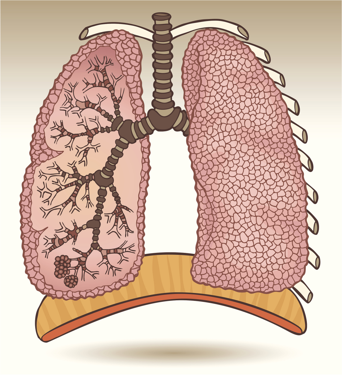 肺气肿一般寿命多少年图片