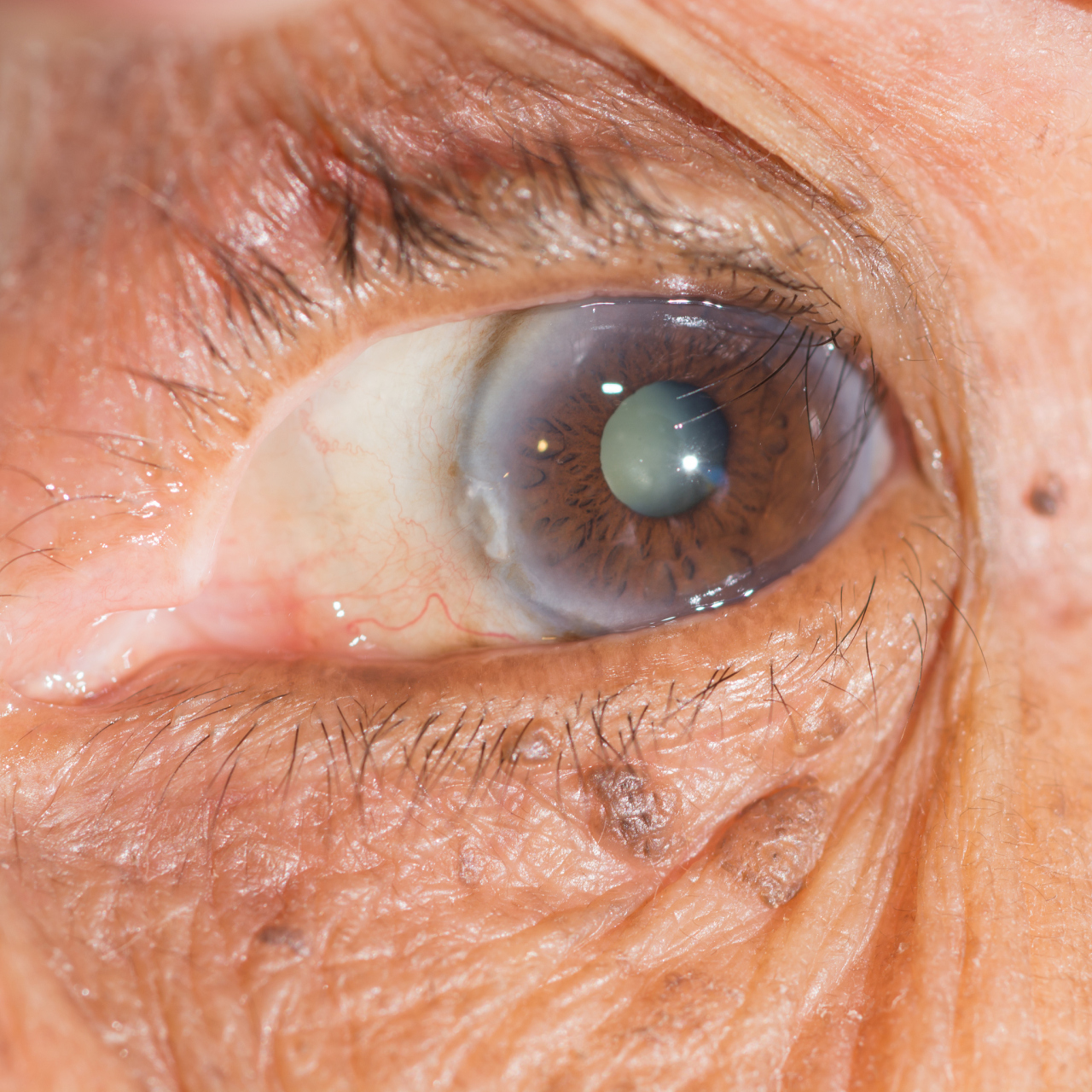 眼睛也有视力缺陷吗 人的眼睛其实有很多缺陷,比如说两个眼睛都长在了