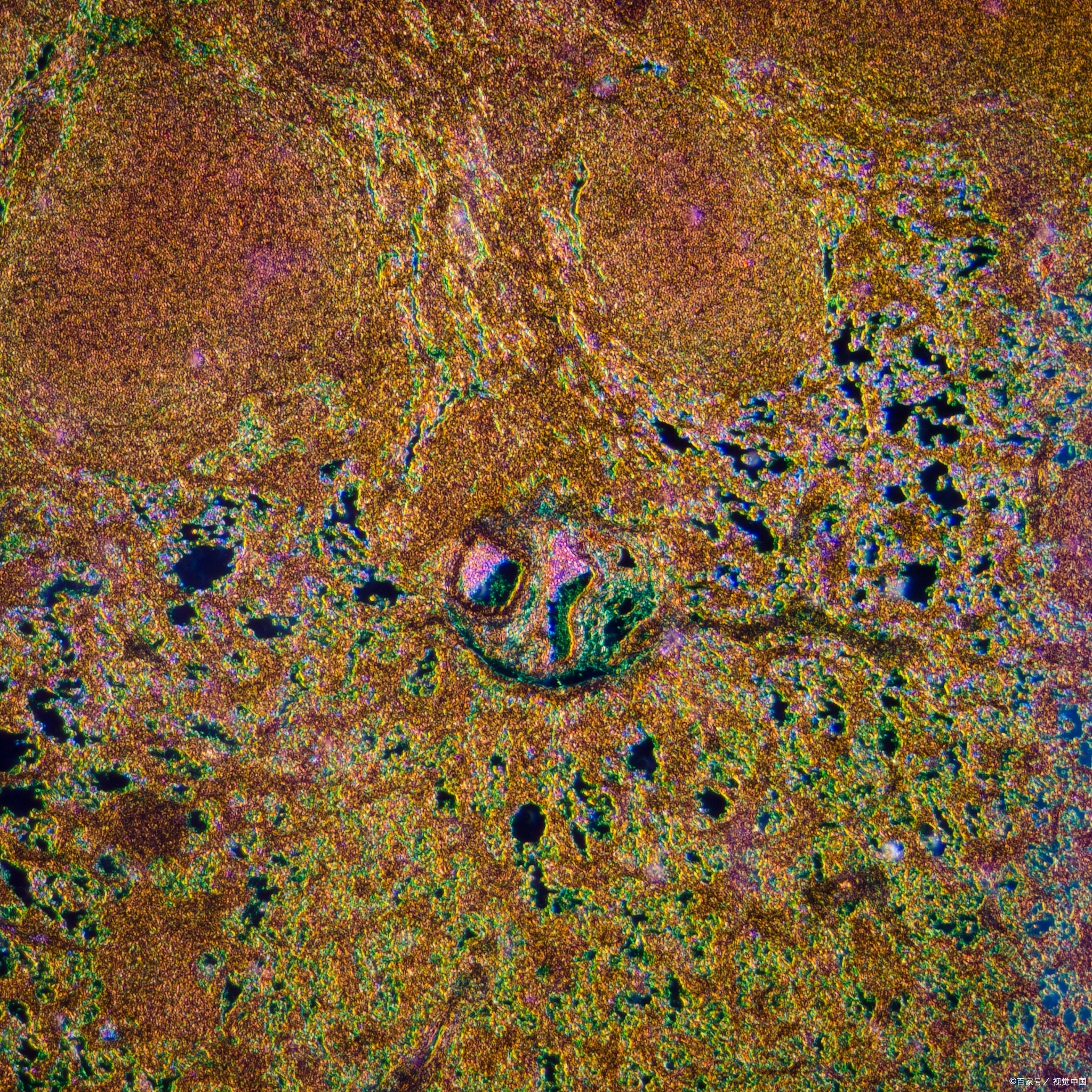 淋巴瘤的"治愈"是一个相对概念,医学上通常以 长期无病生存 作为链膊