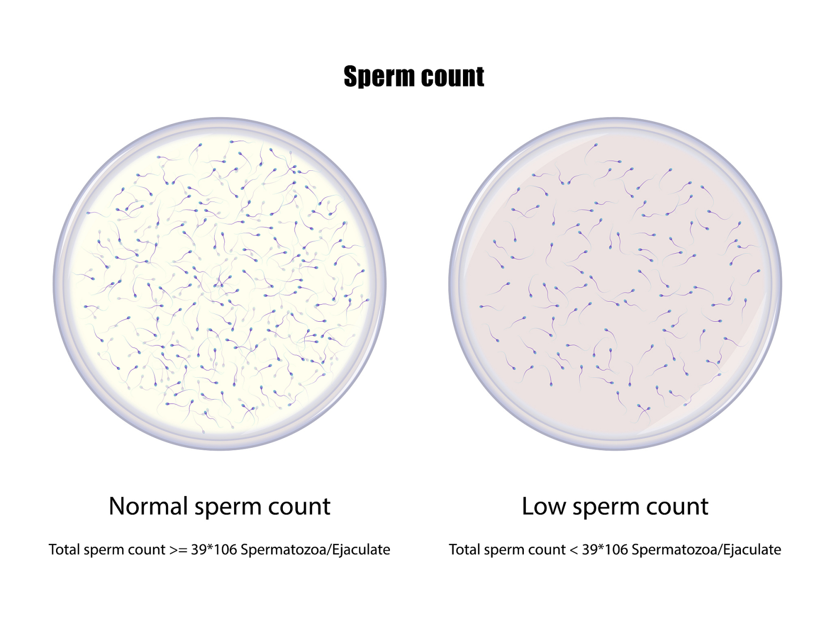 无精症,中医称为命门火衰 射出的精液,3次以上的