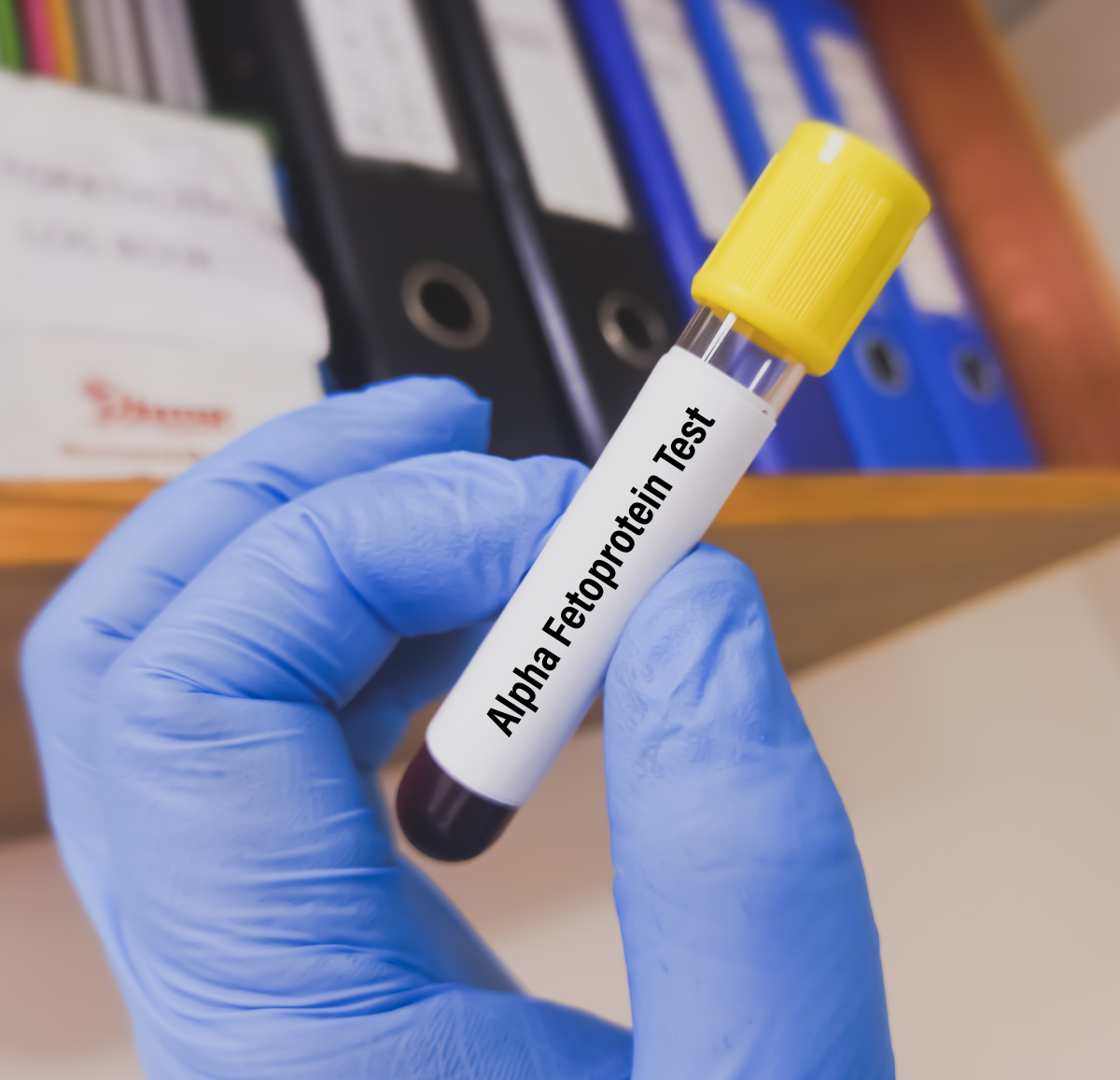 Slu-PP-332 binding | Shaanxi BLOOM Tech Co., Ltd