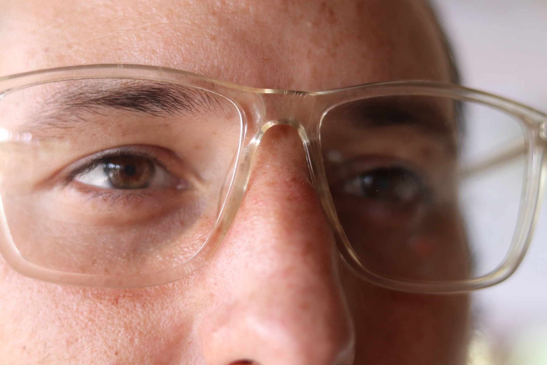 视力模糊可能是许多眼部问题的症状,例如近视,远视,散光,老花等