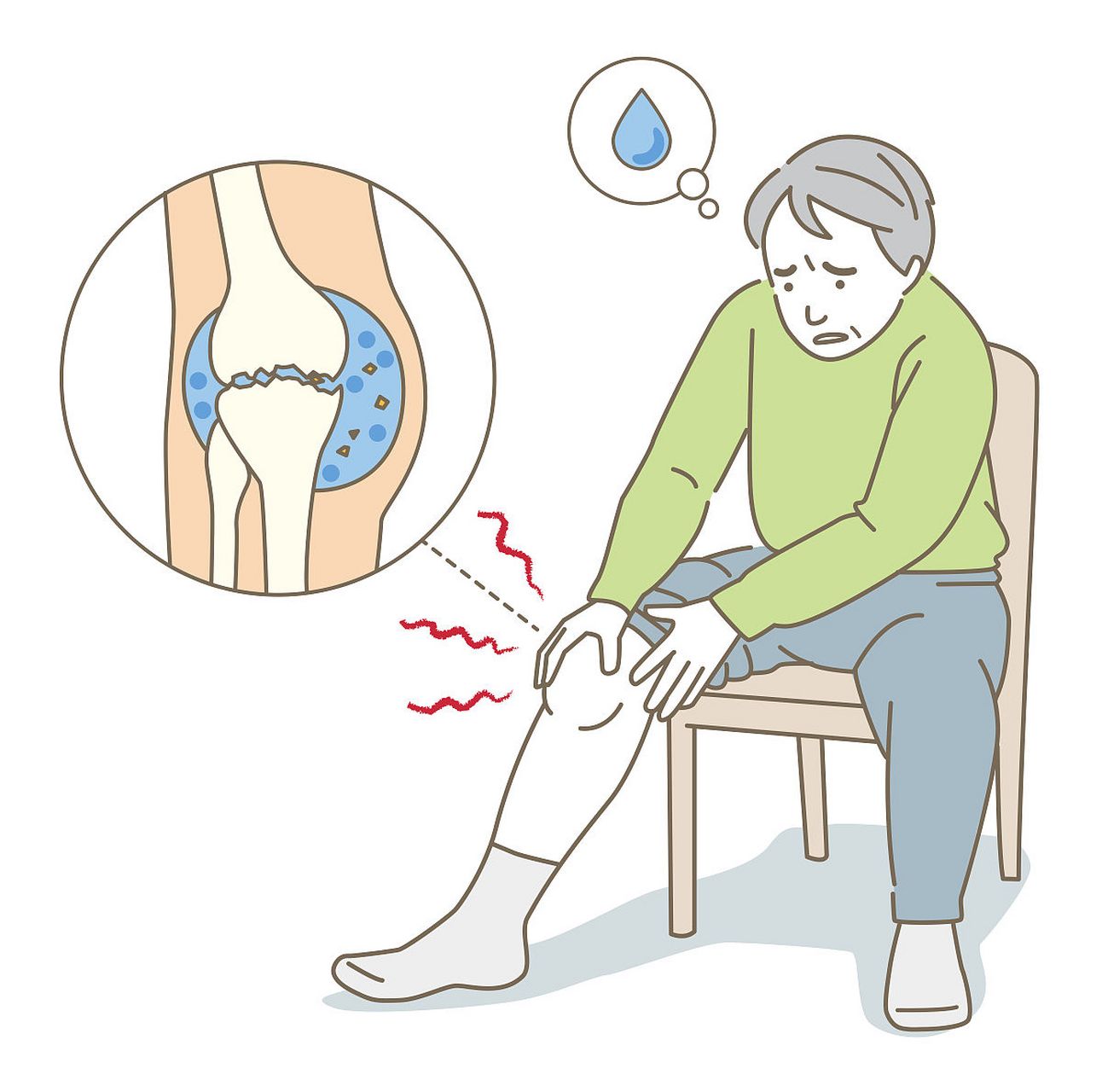 儿童滑膜炎的症状包括关节疼痛,红肿,运动障碍和发热等.