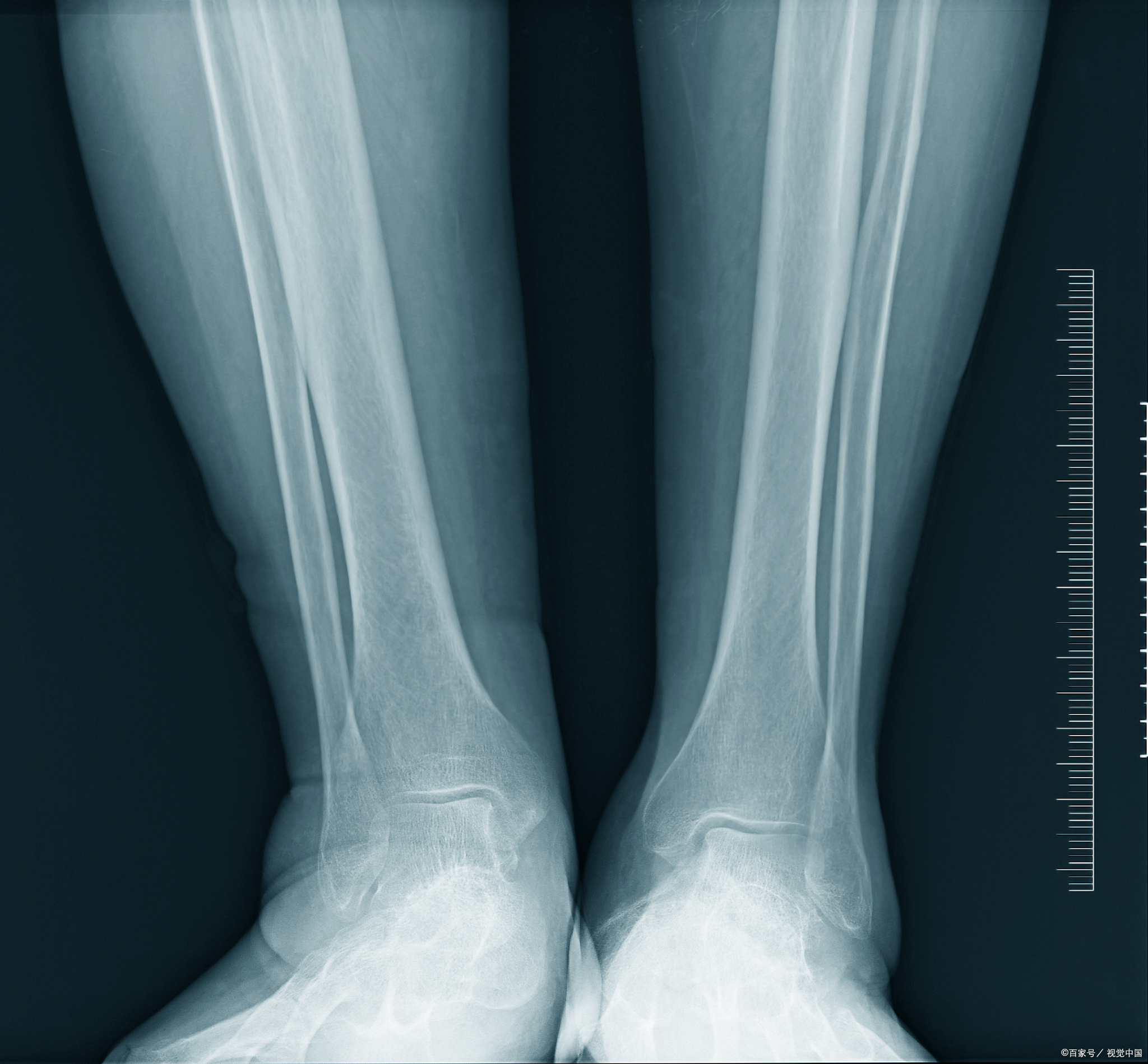 :那是一个阳光明媚的早晨,我如往常一