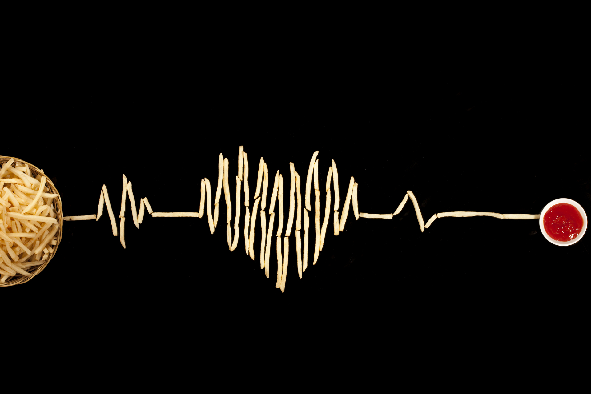 稳定型心绞痛心电图是怎样的  对于稳定型心绞痛患者在没有胸痛情况下