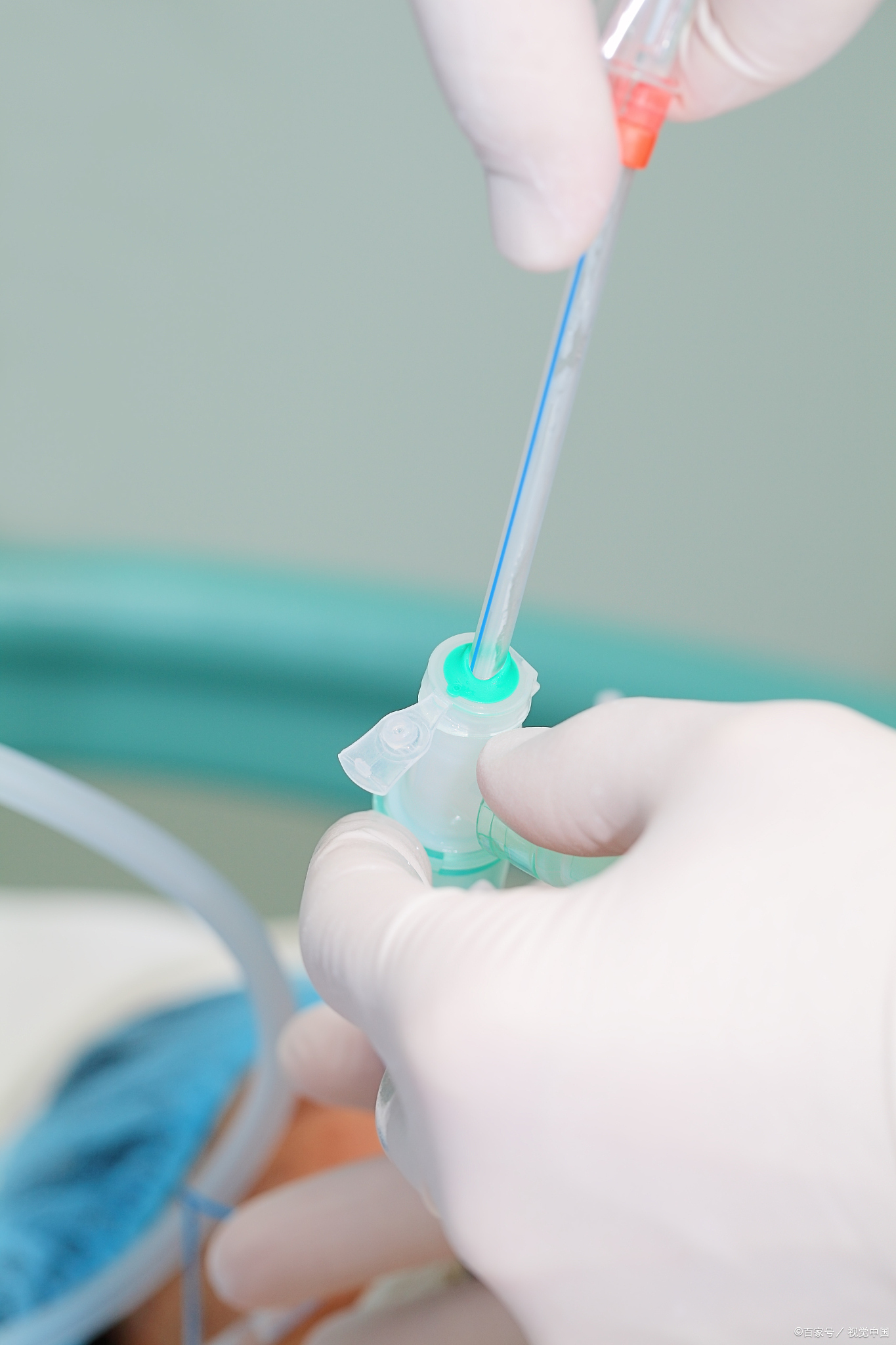 给管道贴安个家,让护理工作更快捷