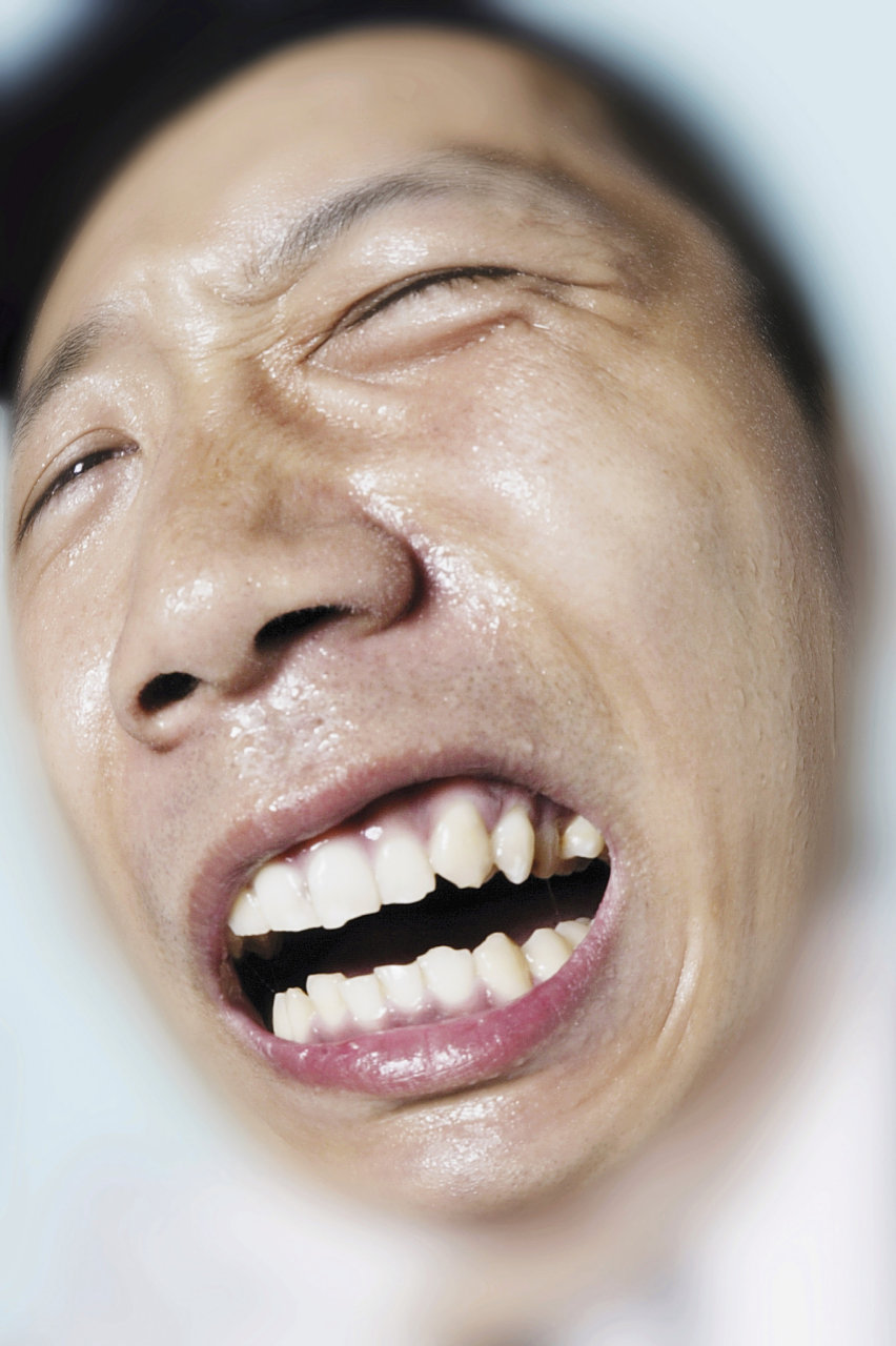 龅牙#   在矫正牙齿的过程中,不同的患者会有不同的需要和反应.