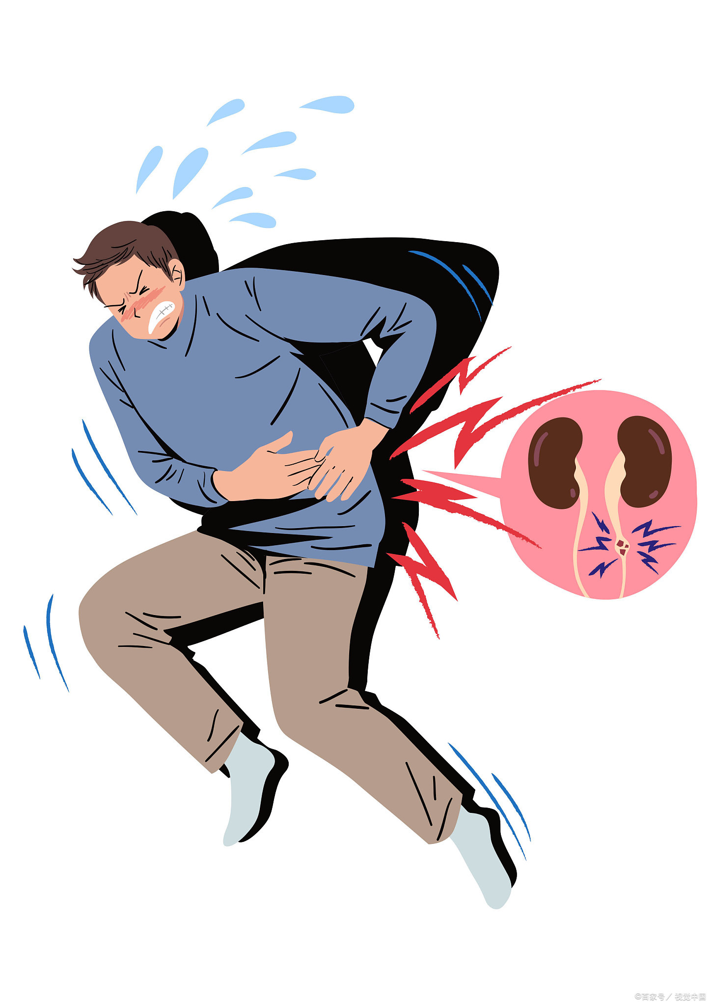 卡通肾结石肾绞痛图片大全肾痛肾绞痛的图片肾痛图片肾结石疼的图片