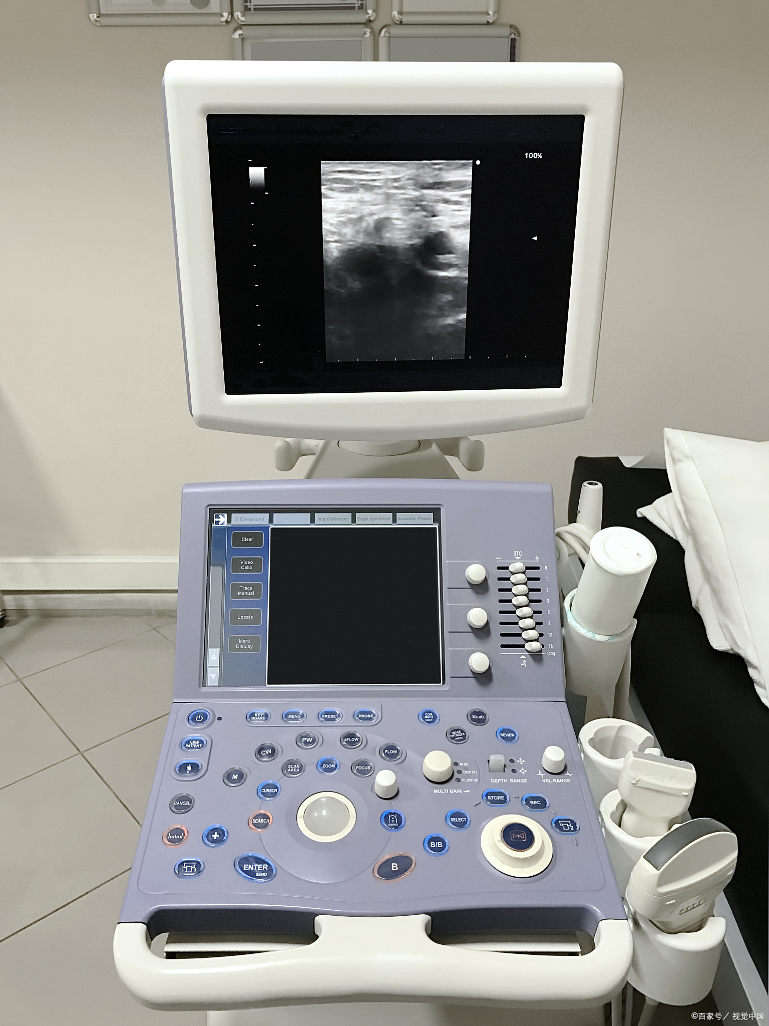 从医学角度来看,彩超属于超声波检查,它并不