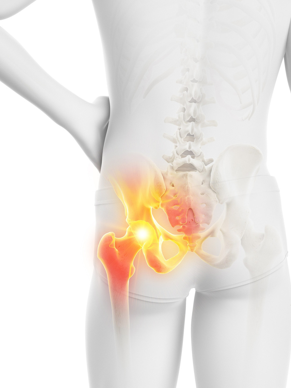 今天就来教大家如何判断自己是否可能得了髋关节疾病.