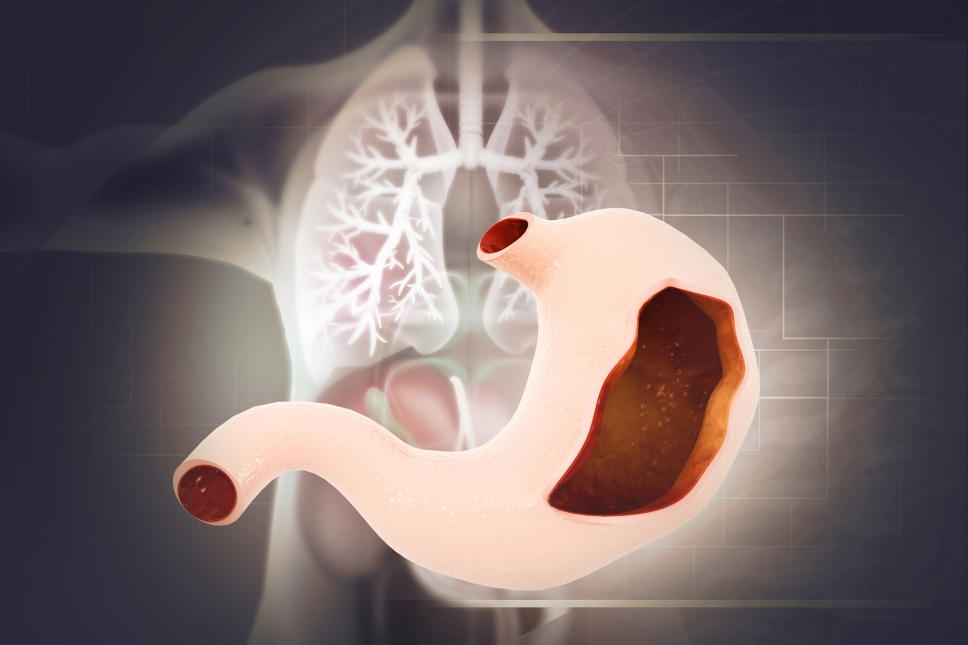 沈阳胃肠医院# 这四种食物,对胃伤害很大!