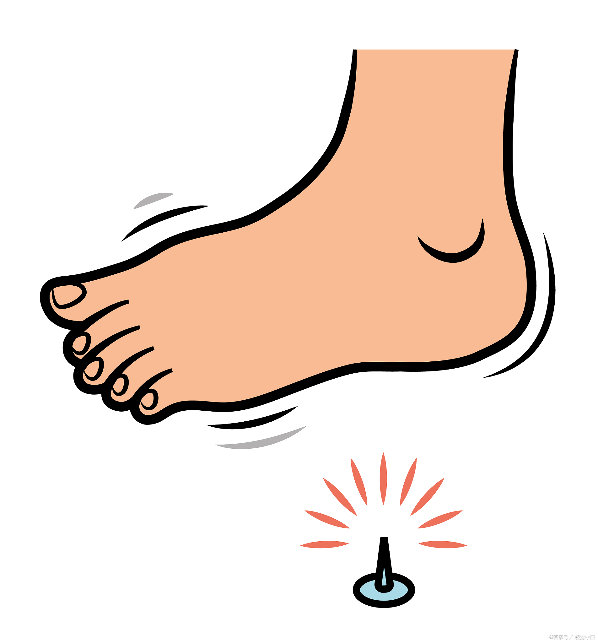 足部疼痛,酸胀等症状仍反复发作,严重足部刺痛感图卡通图片