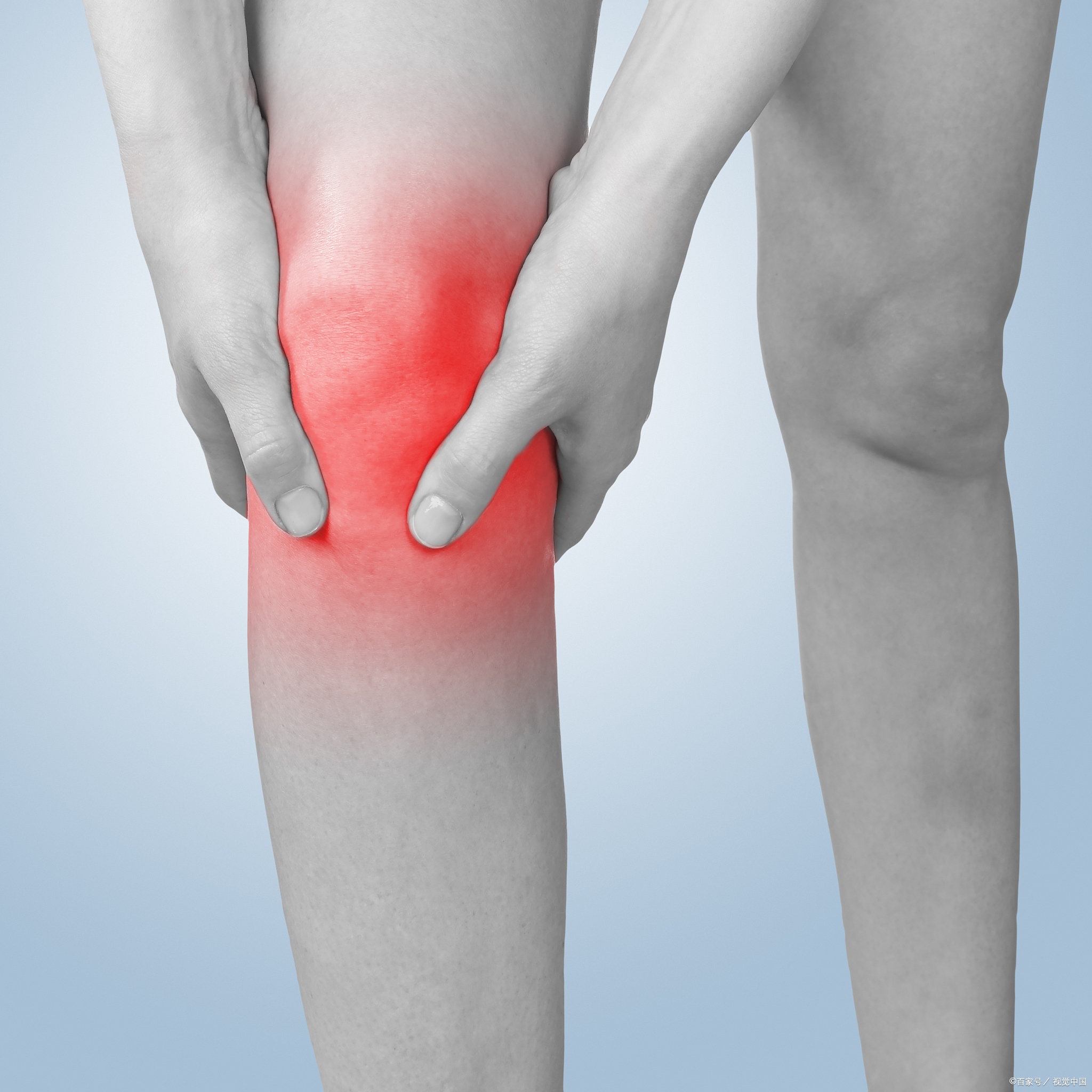 膝关节滑膜炎早期症状  1,轻度滑膜炎:主要为关节疼痛,关节肿胀不明显