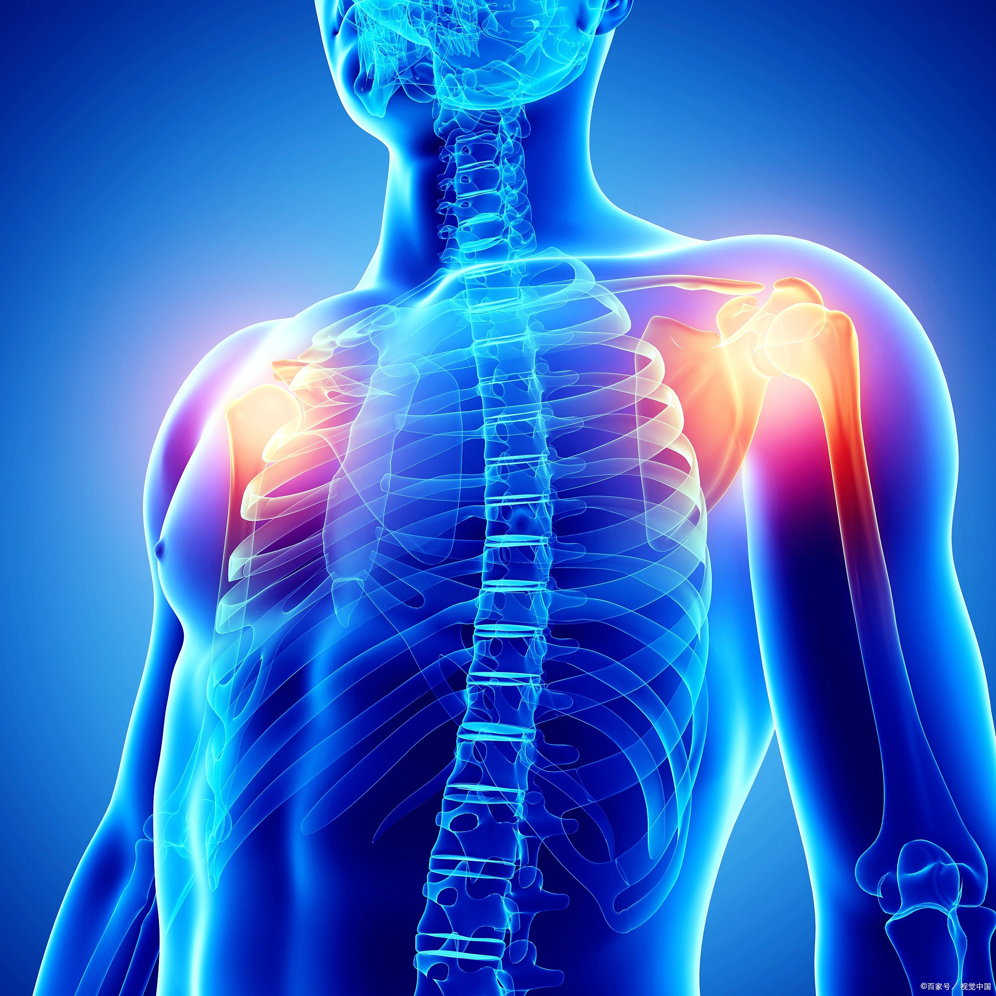 背部两边骨头疼痛什么引起的