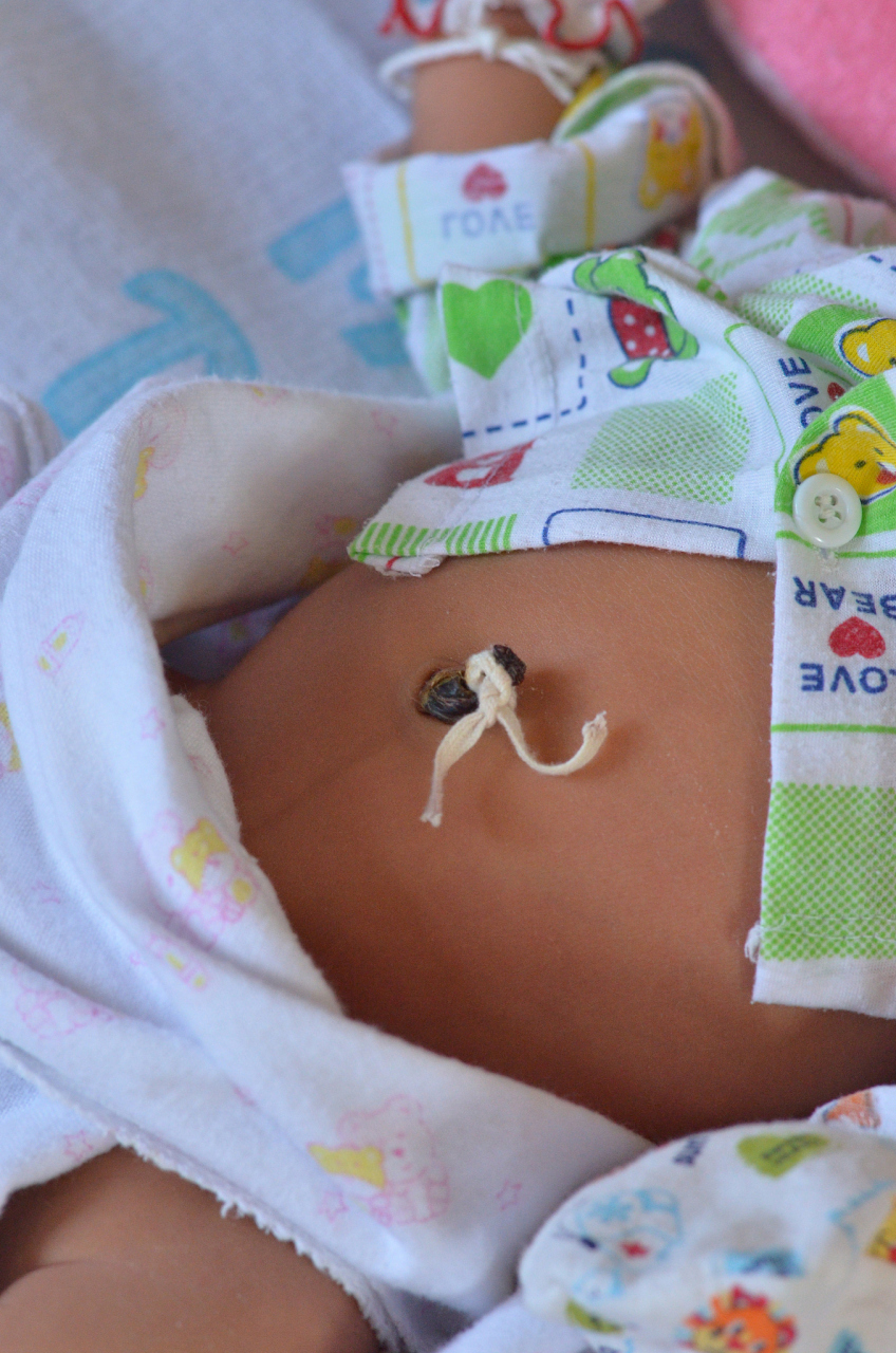 a:宝宝脐带未脱落前,脐部尽量不要碰水,洗澡时可以用肚脐防水贴保护