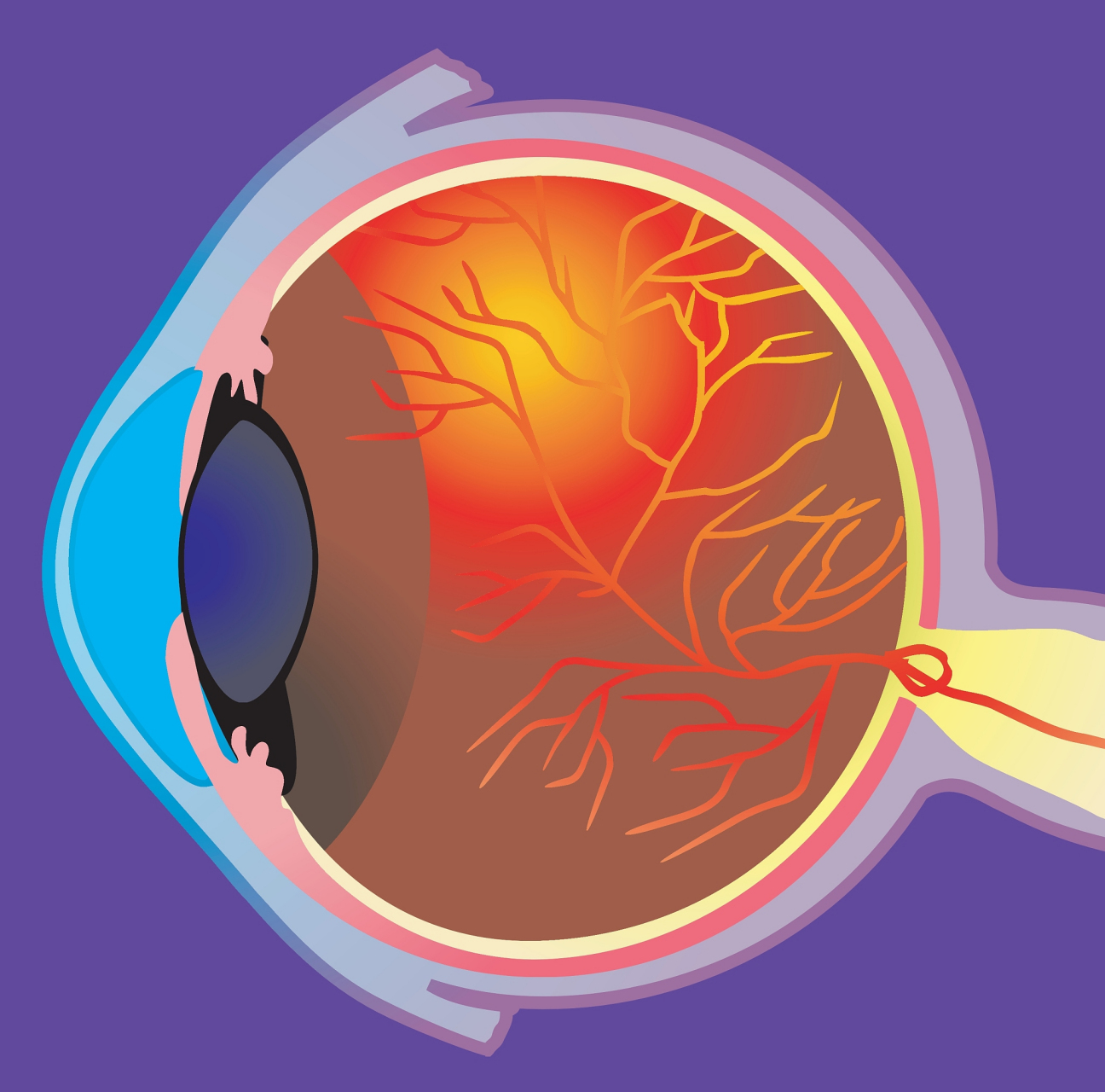 眼部问题如角膜干燥和眼疲劳日益突出,影响视力和生活品质.