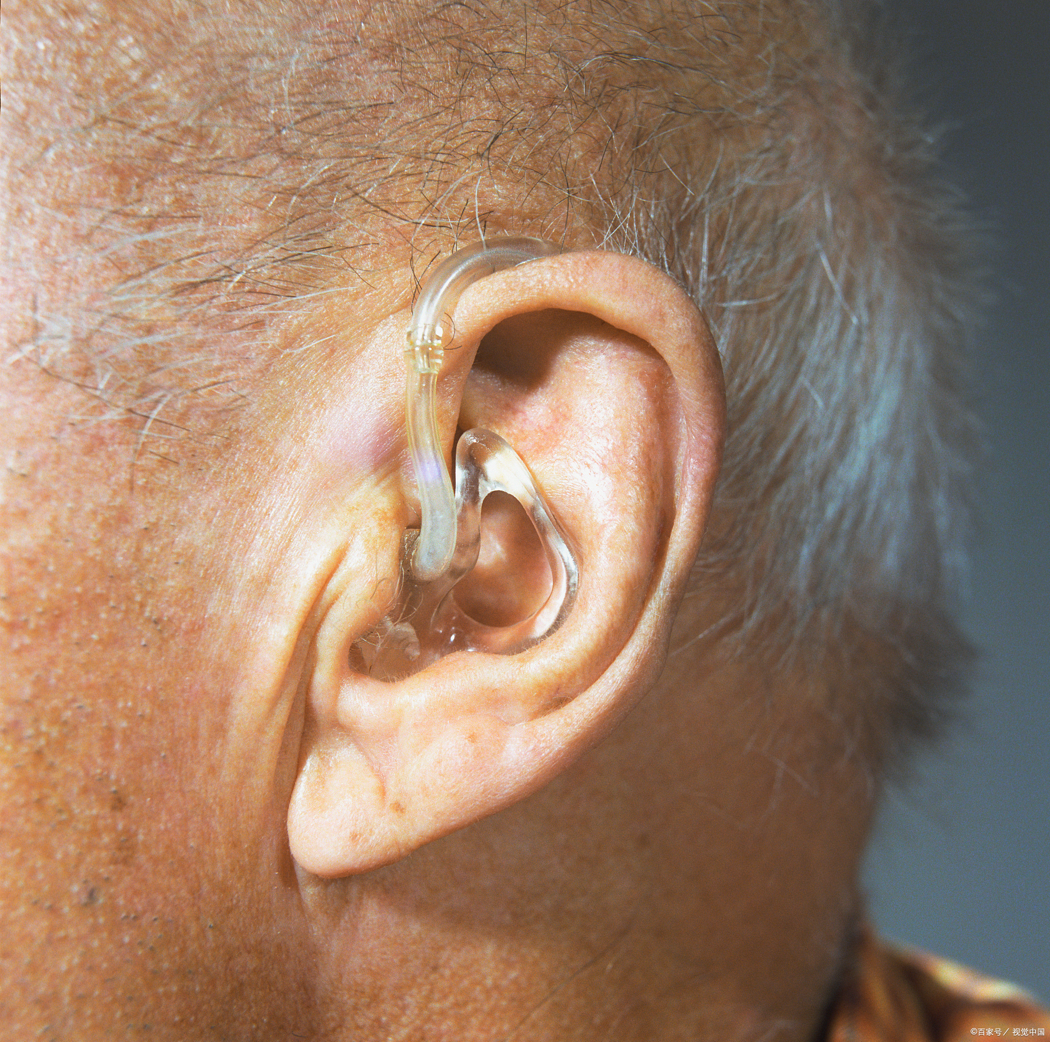助听器的不到5%最近遇到好多网购助听器翻车的案例