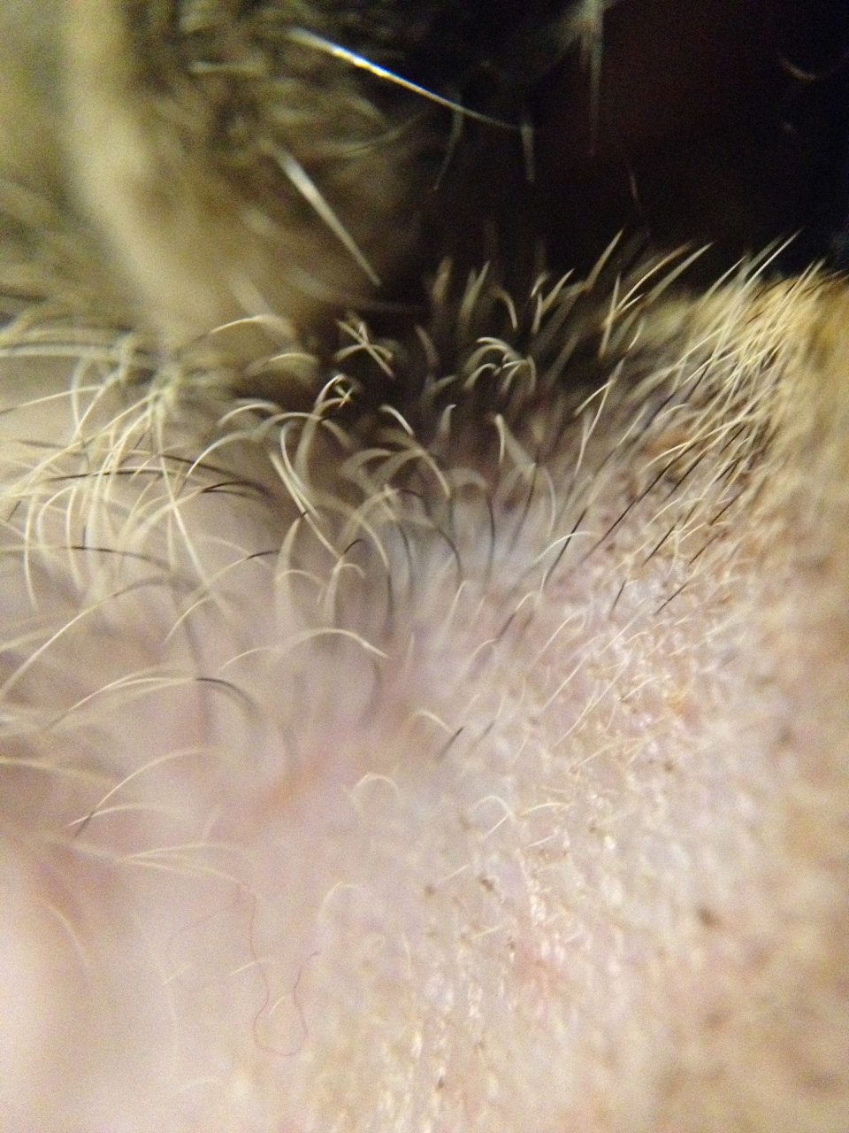 阴蒂旁边长了痘痘会是什么呢?