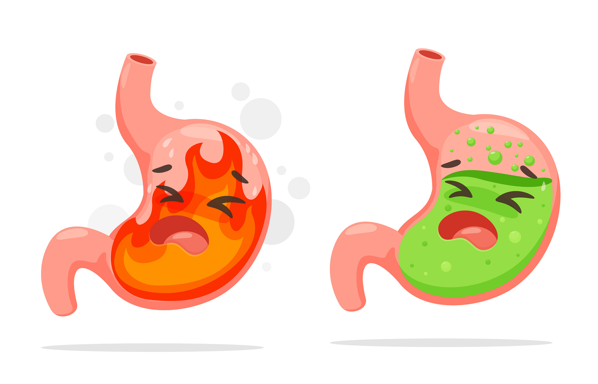 胃食管反流病思维导图图片