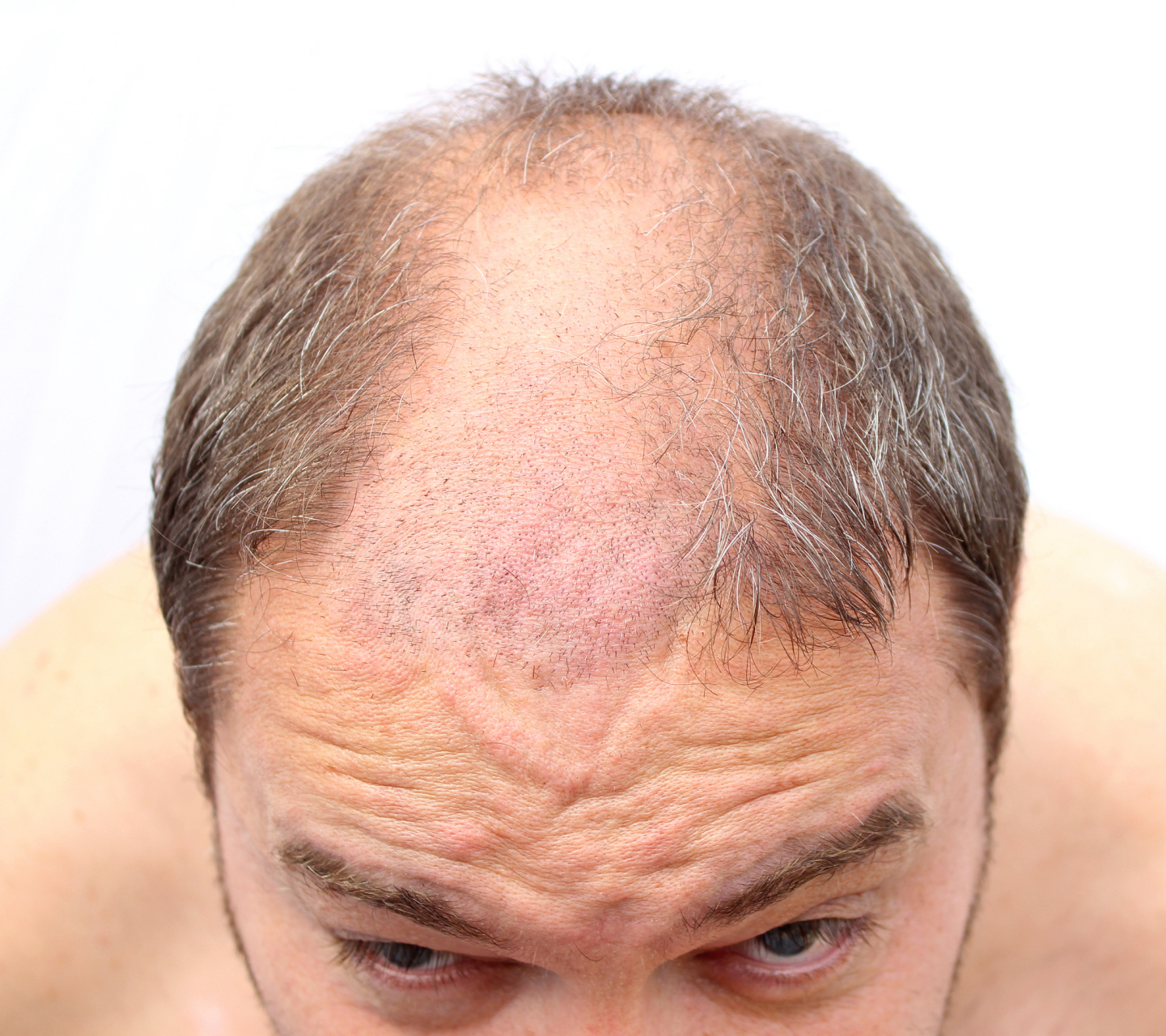 一个秃顶的男人和一个女人在一起,男人说:"你知道吗?