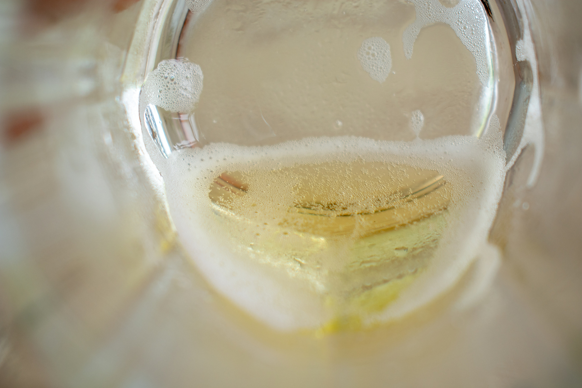 肾炎泡沫尿的护理 由于有肾炎的患者尿液当中有尿蛋白,张力改变所导致