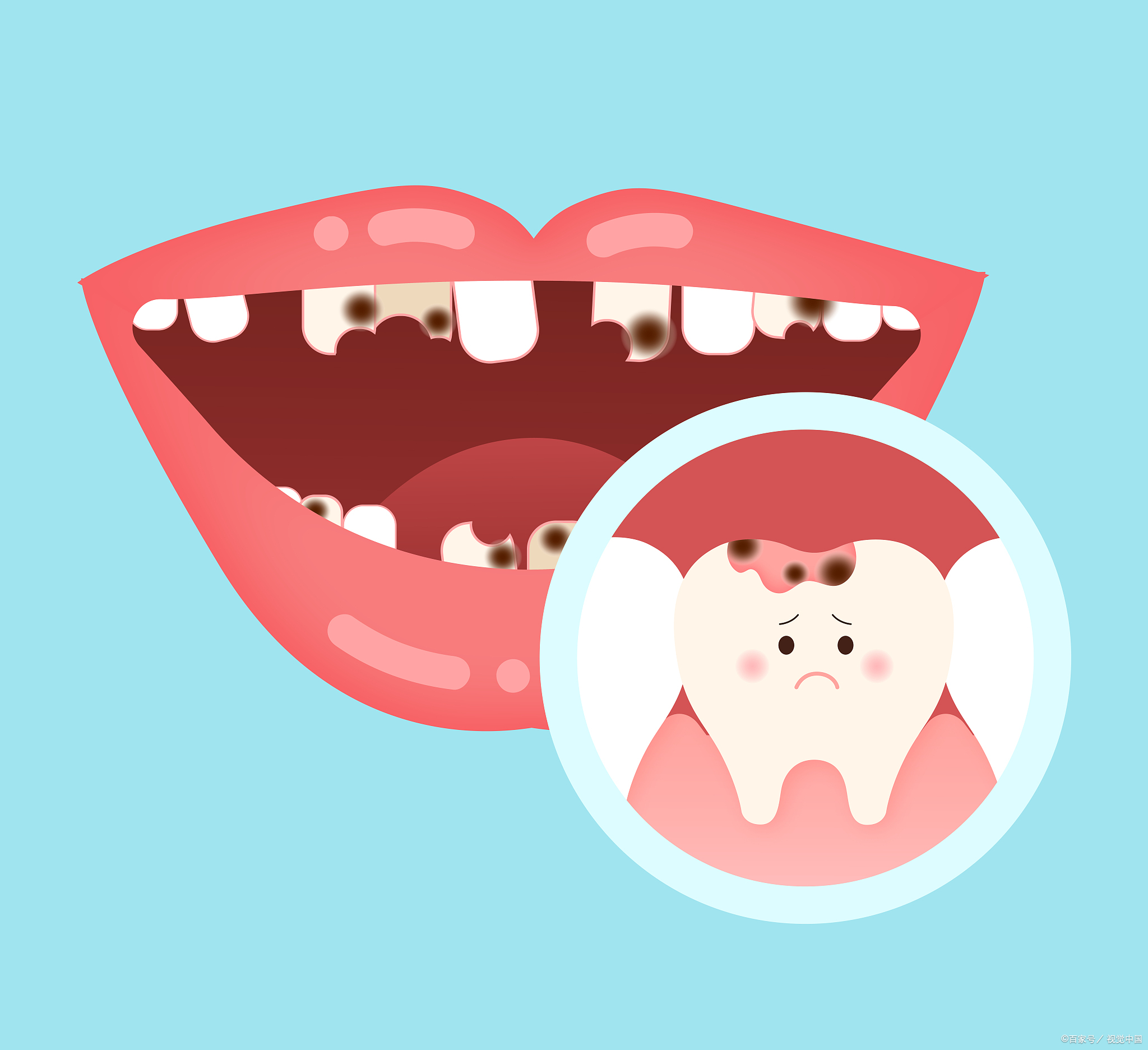 "小时候不敢吃糖没有长虫牙;长大后却有了蛀牙,明白牙痛的感受,才理解