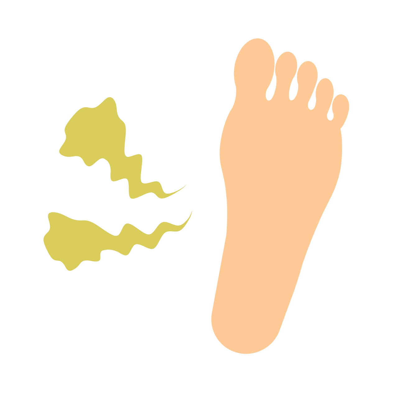 脚气是一种常见的皮肤病,它的发病率较高,可以影响个人的身体健康和