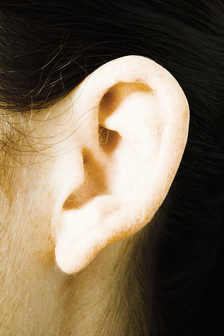 招风耳矫正最佳年龄  招风耳矫正手术一般是在5-6岁后,耳朵停止生长