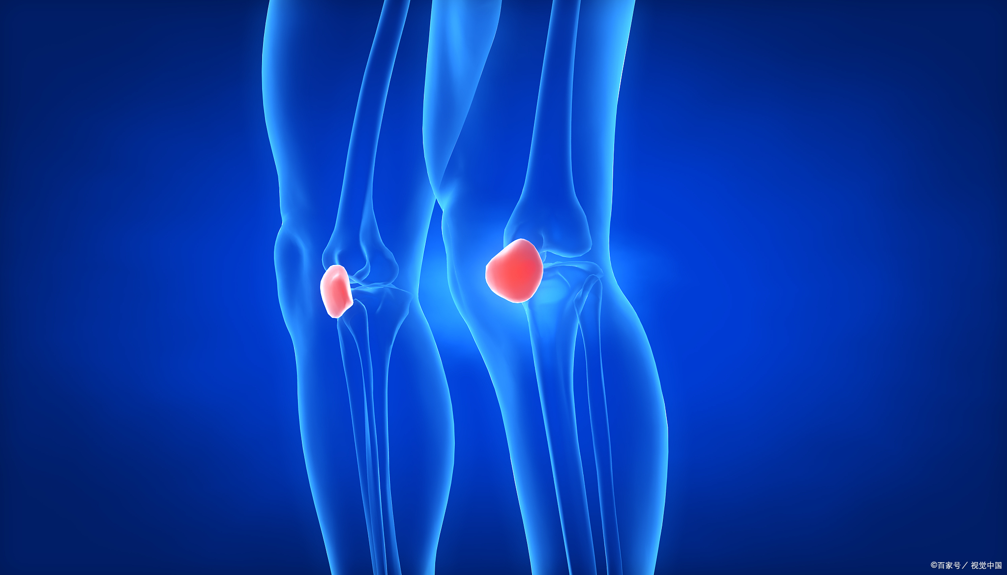 全民运动之"保护你的膝盖"