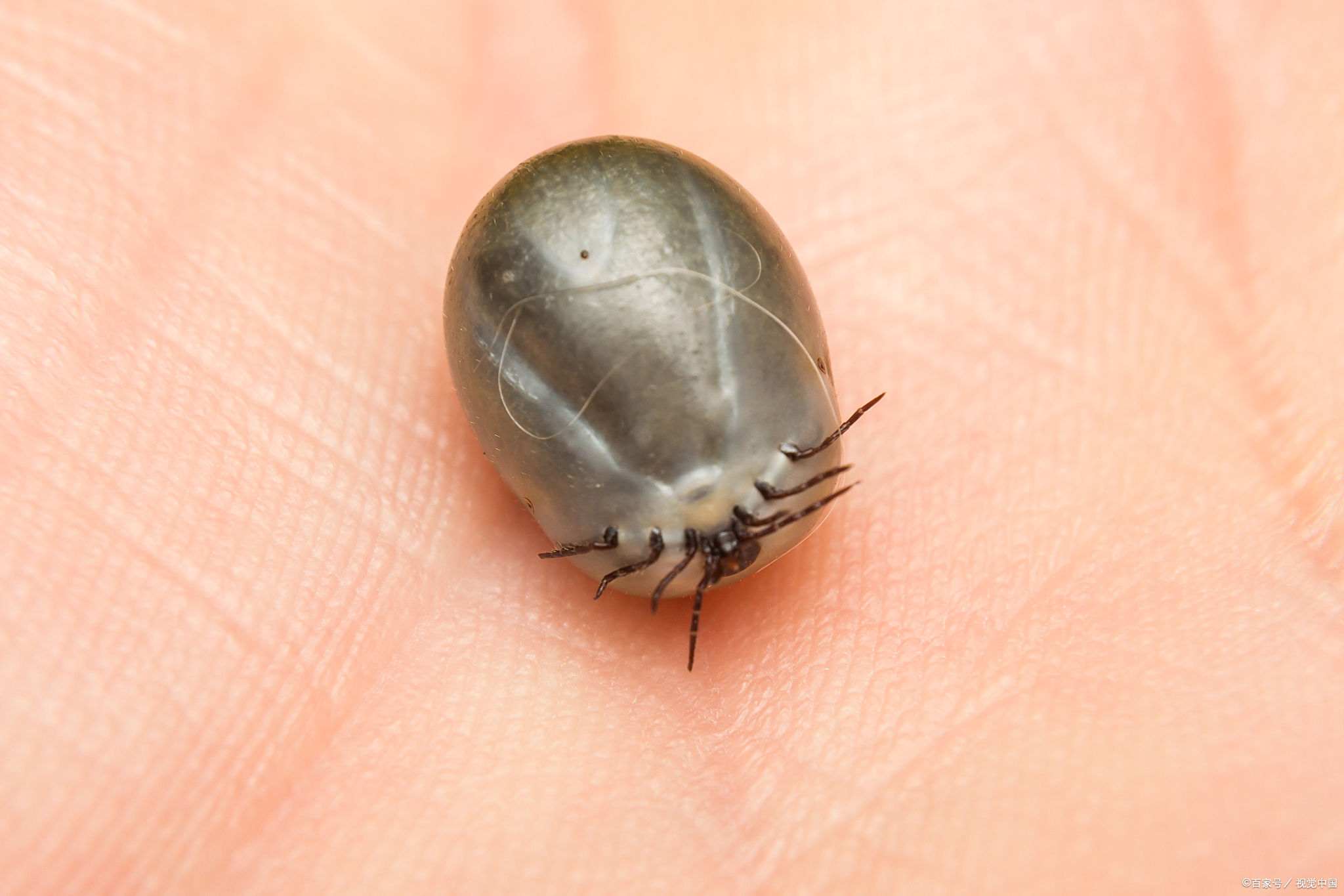 很多朋友会把狗狗身上的蜱虫看作肿瘤,甚至有些主人以为小狗的黄痂
