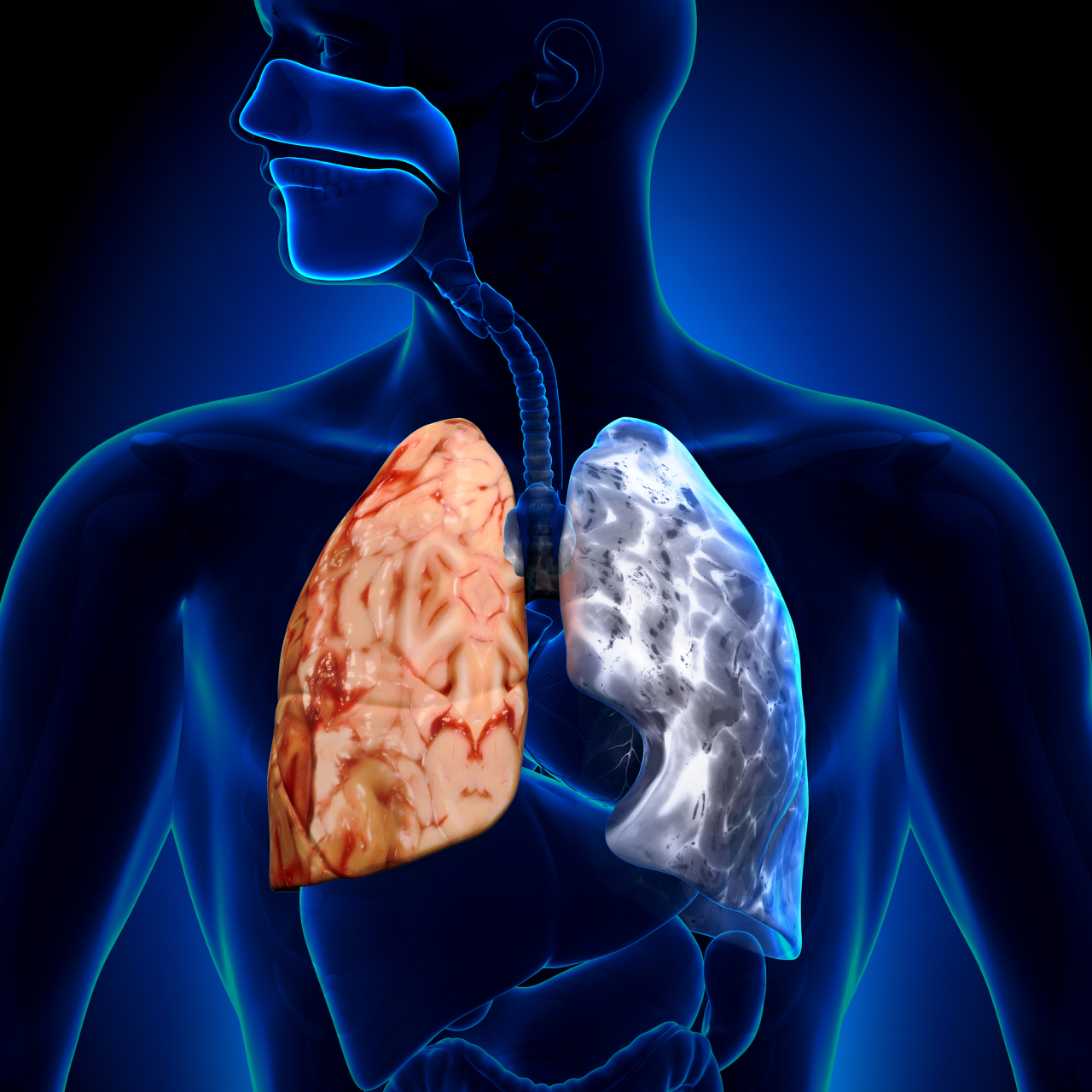 戒烟后,肺会恢复正常吗?