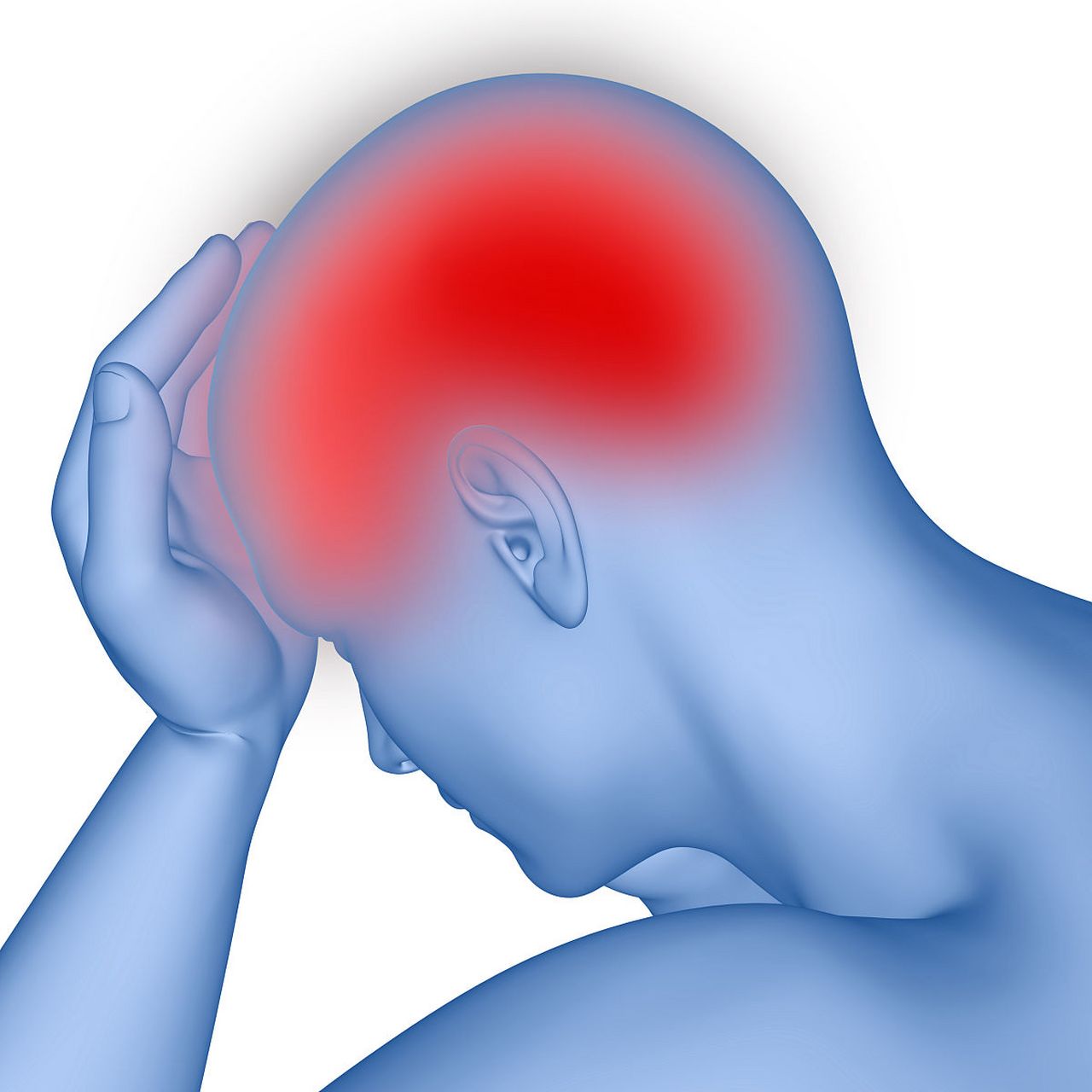 前庭性偏头痛(vestibular migraine)是一种常见的偏头痛类型,其主要
