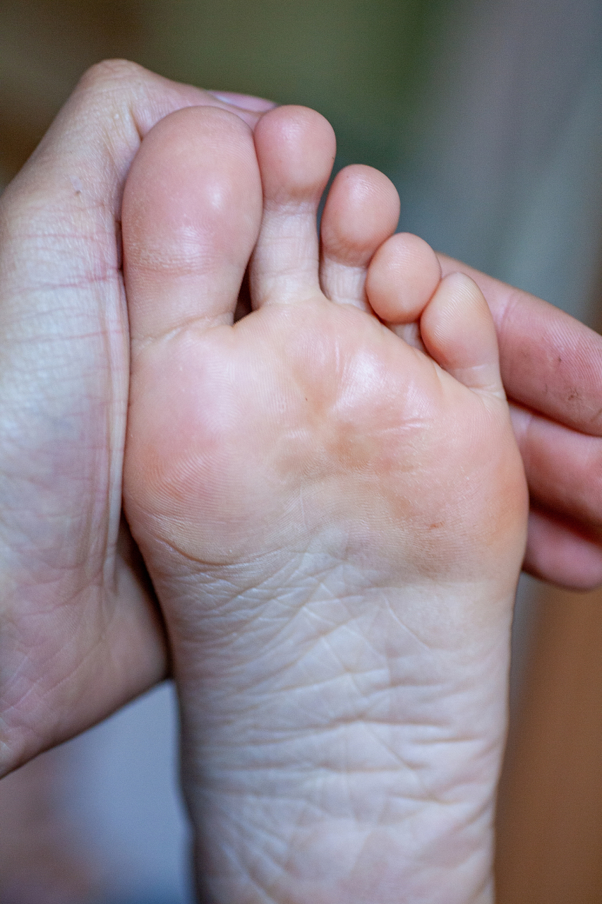 肝不好脚知道,有这3个症状,当心肝扛不住了  第一,脚掌纹路增多,肝主